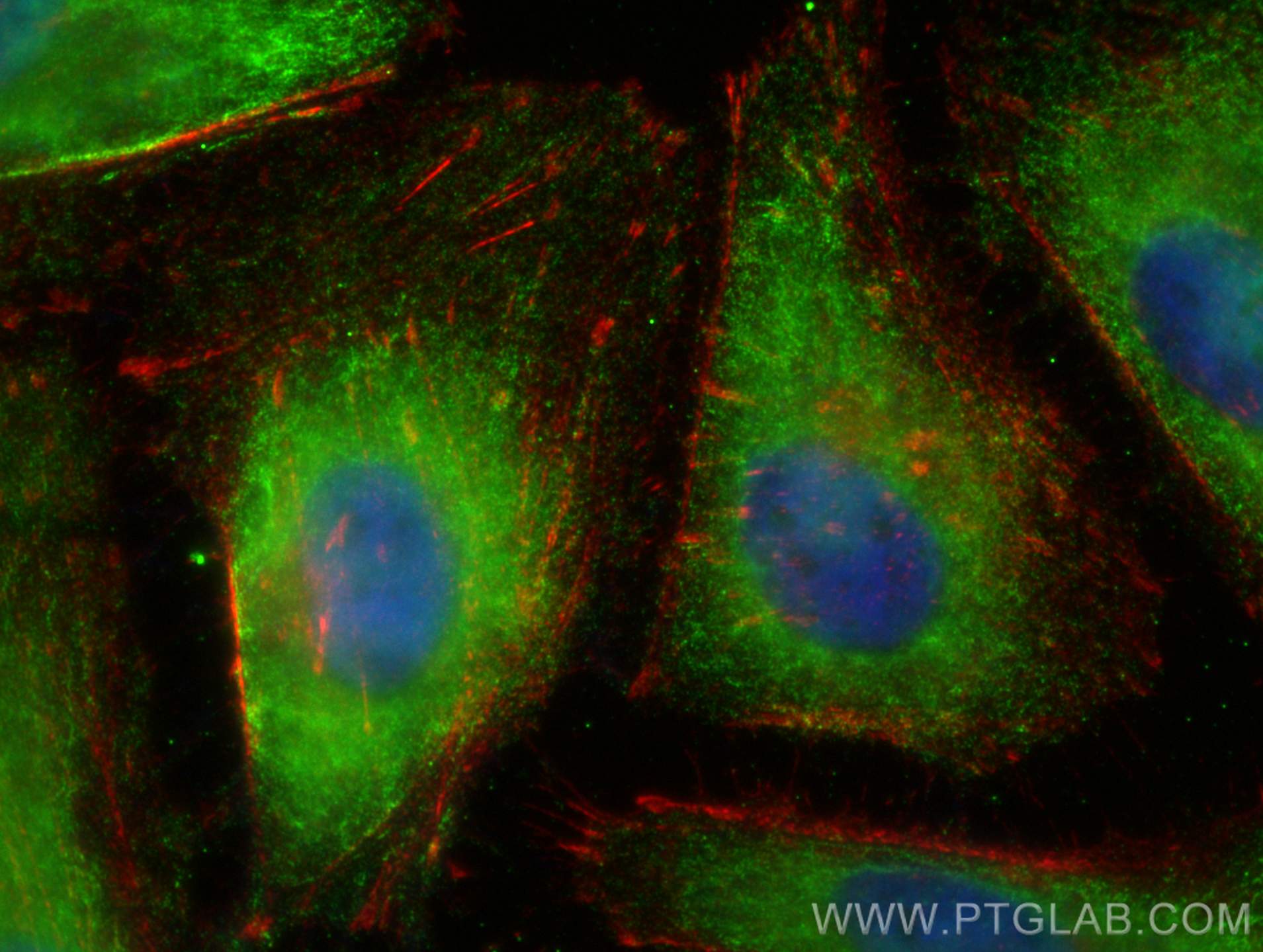 IF Staining of HeLa using 68726-1-Ig (same clone as 68726-1-PBS)