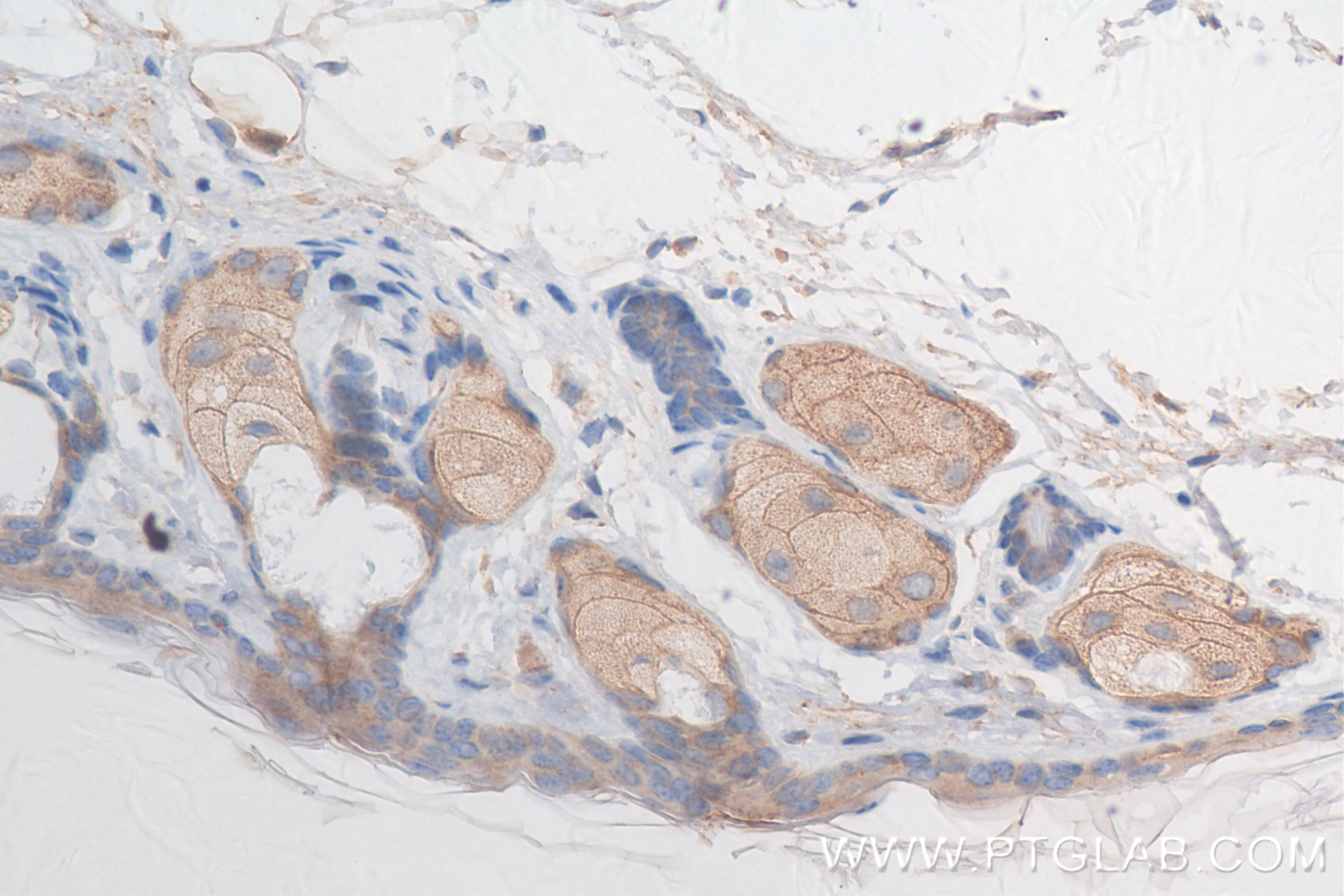 IHC staining of mouse skin using 83613-6-RR (same clone as 83613-6-PBS)