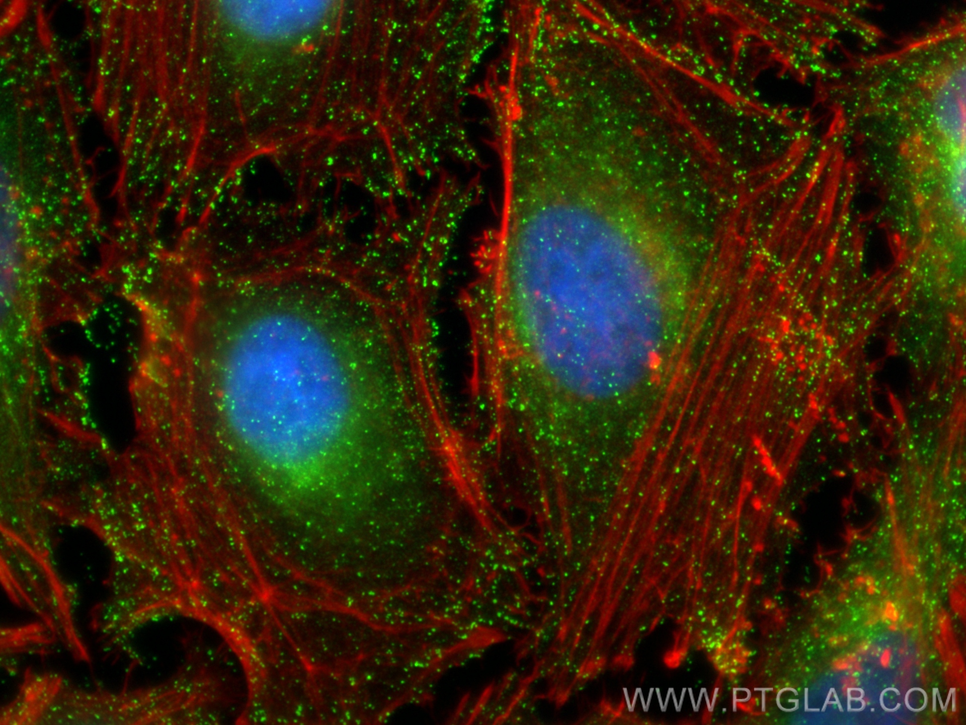 IF Staining of HeLa using 15690-1-AP