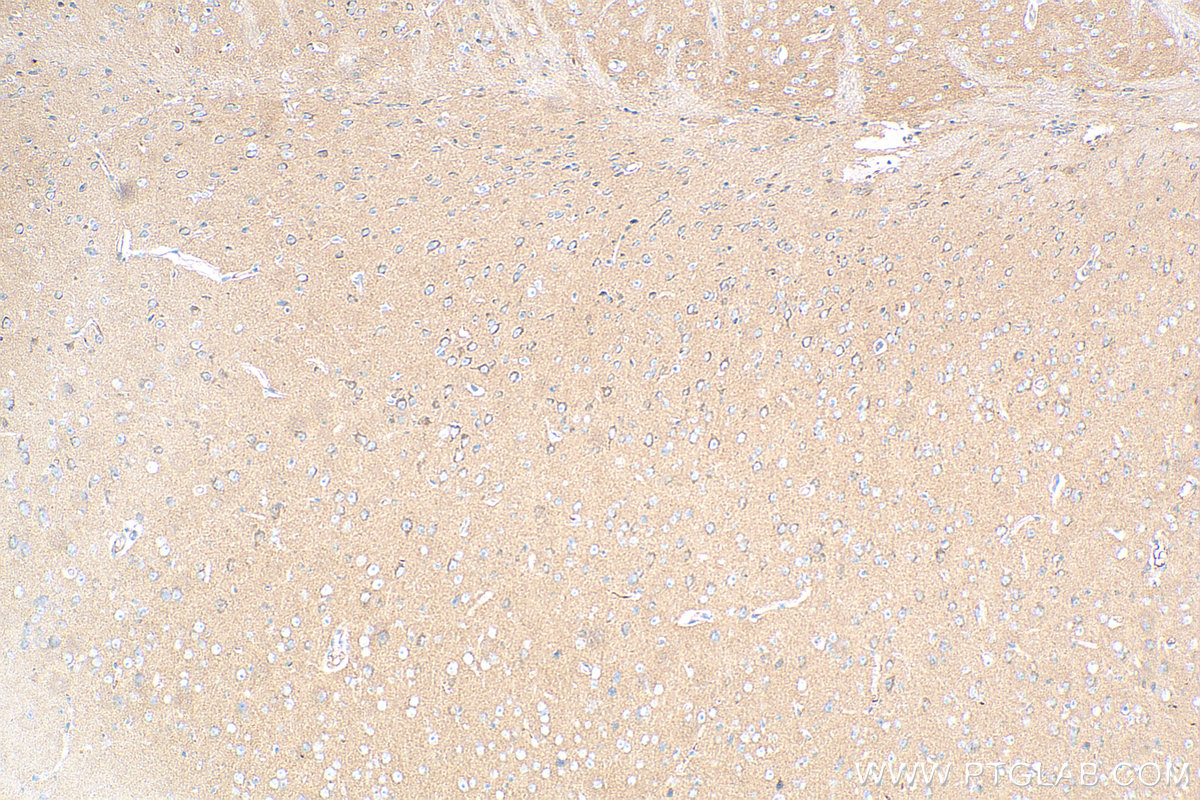 IHC staining of rat brain using 68349-1-Ig (same clone as 68349-1-PBS)