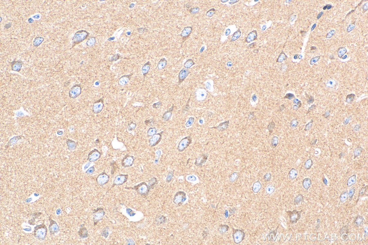 IHC staining of rat brain using 68349-1-Ig (same clone as 68349-1-PBS)