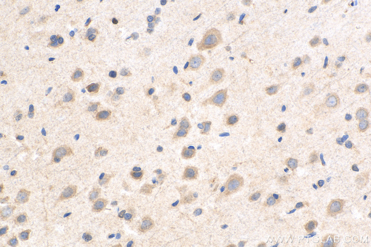 IHC staining of rat brain using 13384-1-AP