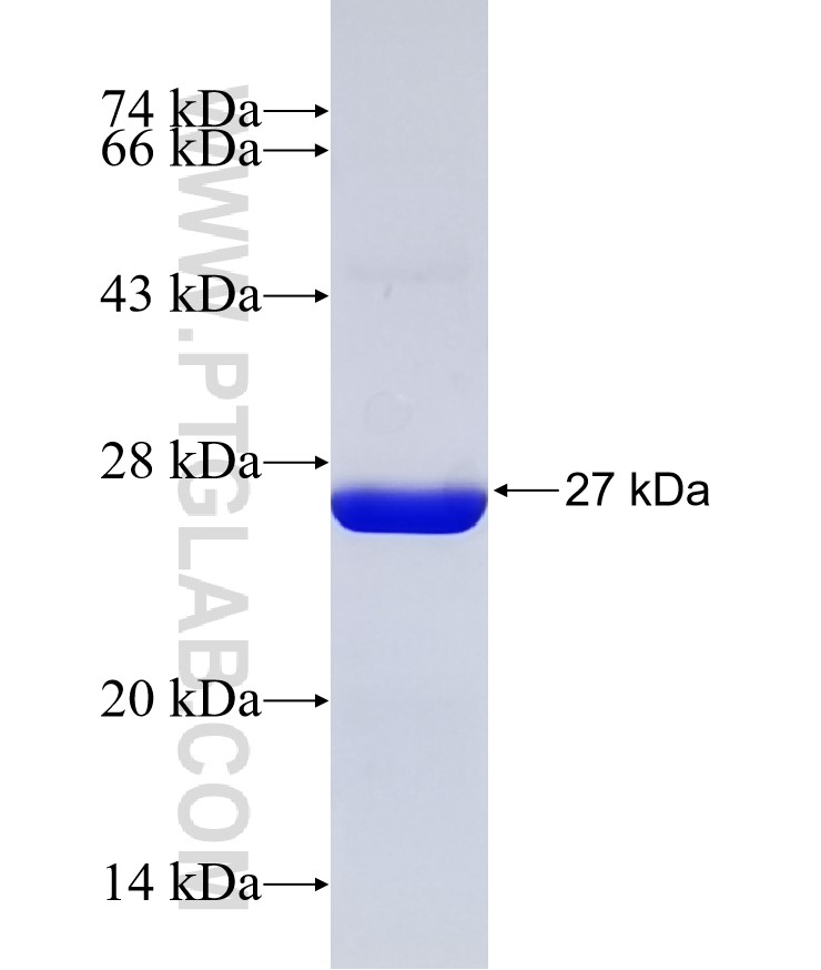 AP4M1 fusion protein Ag32292 SDS-PAGE