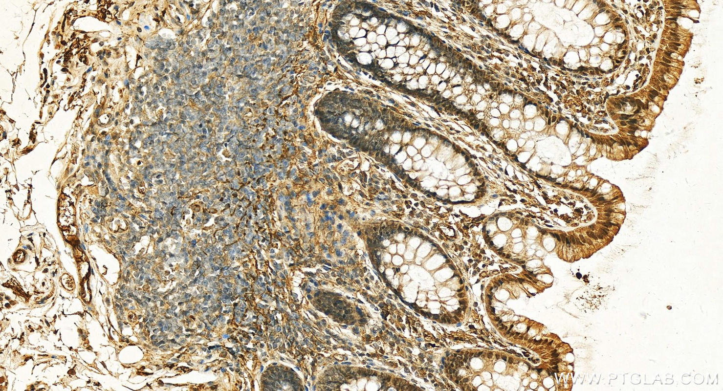 IHC staining of human normal colon using 20773-1-AP