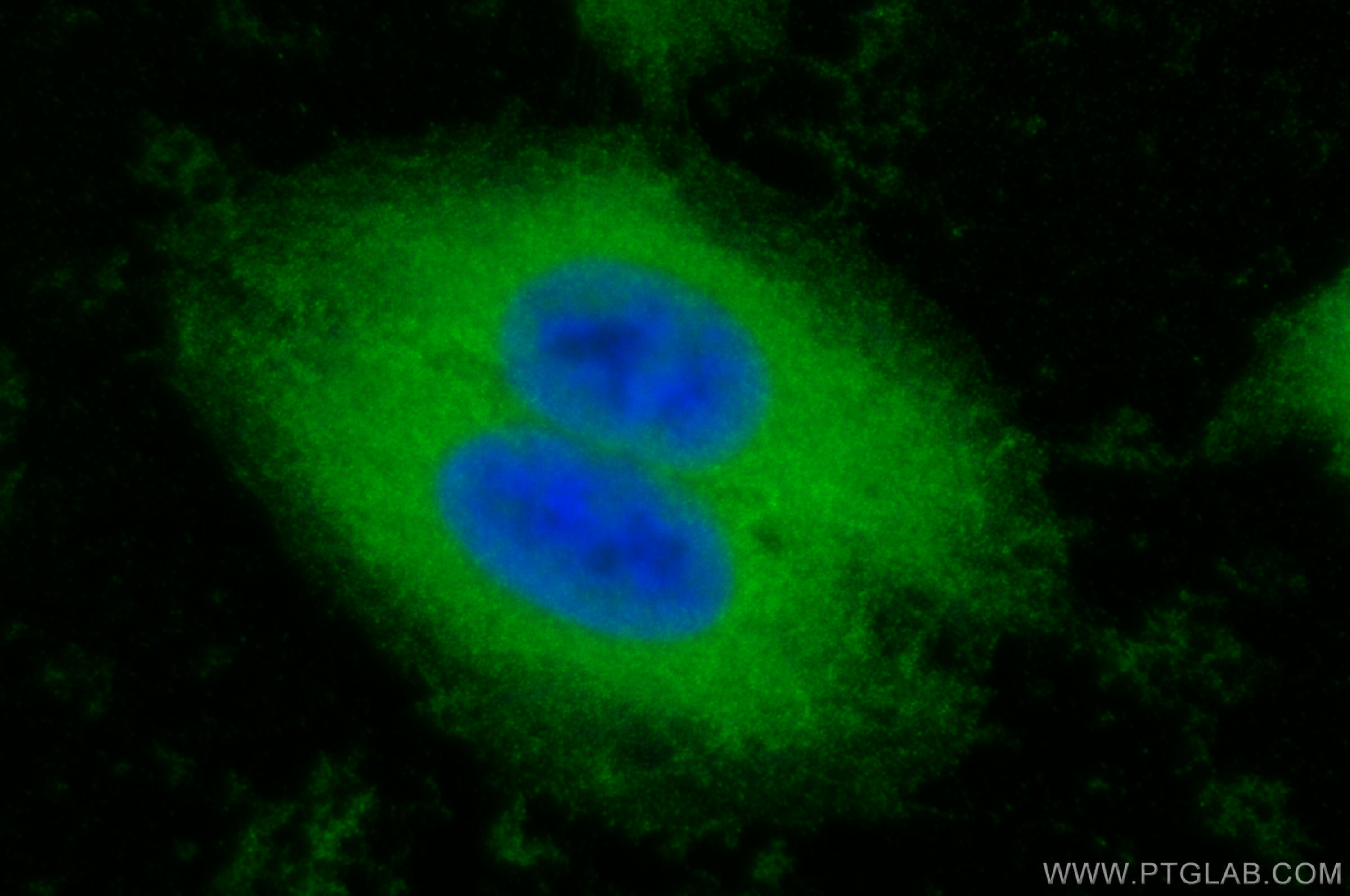 IF Staining of HepG2 using 14758-1-AP