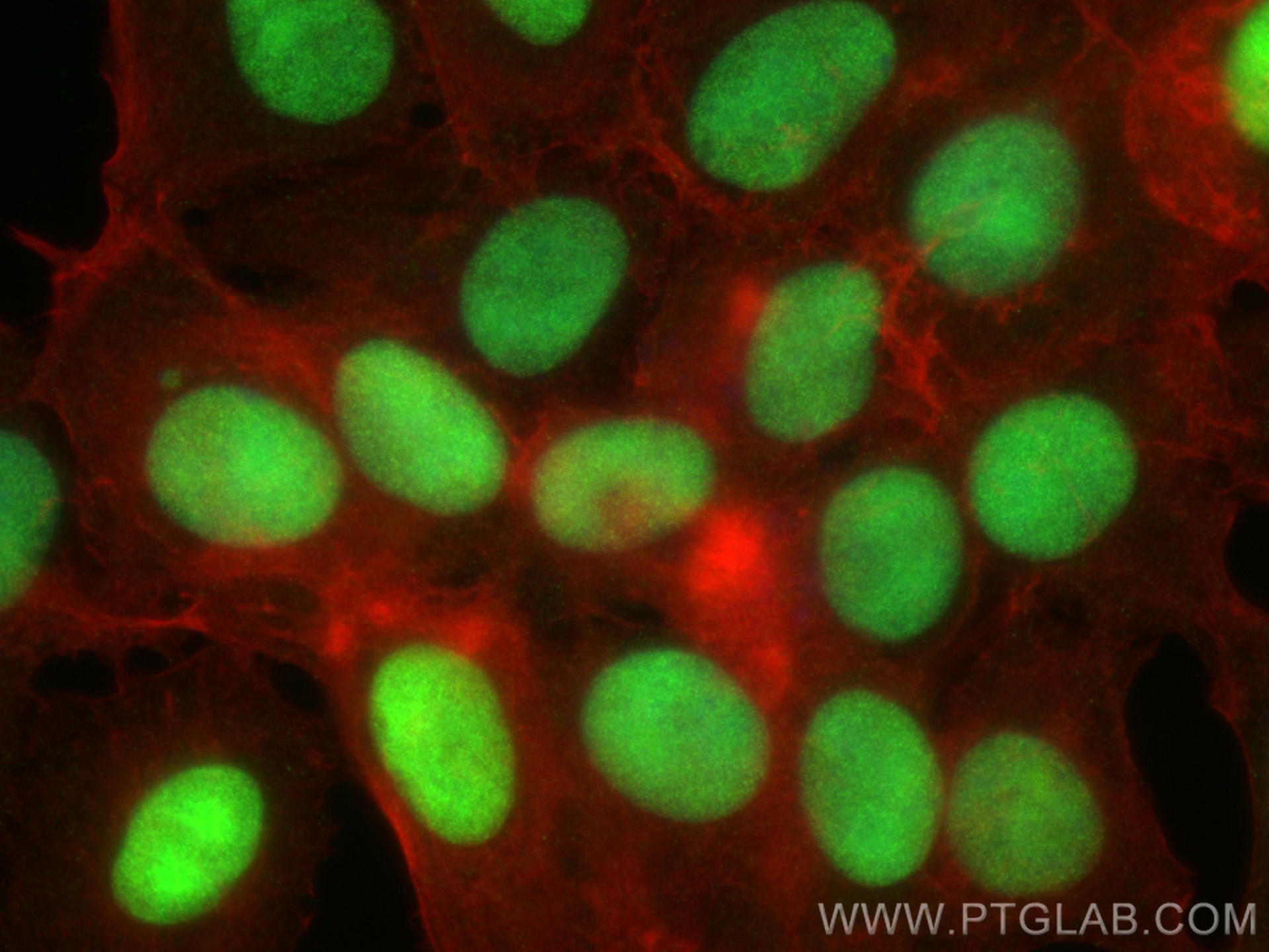 IF Staining of MCF-7 using 10203-1-AP