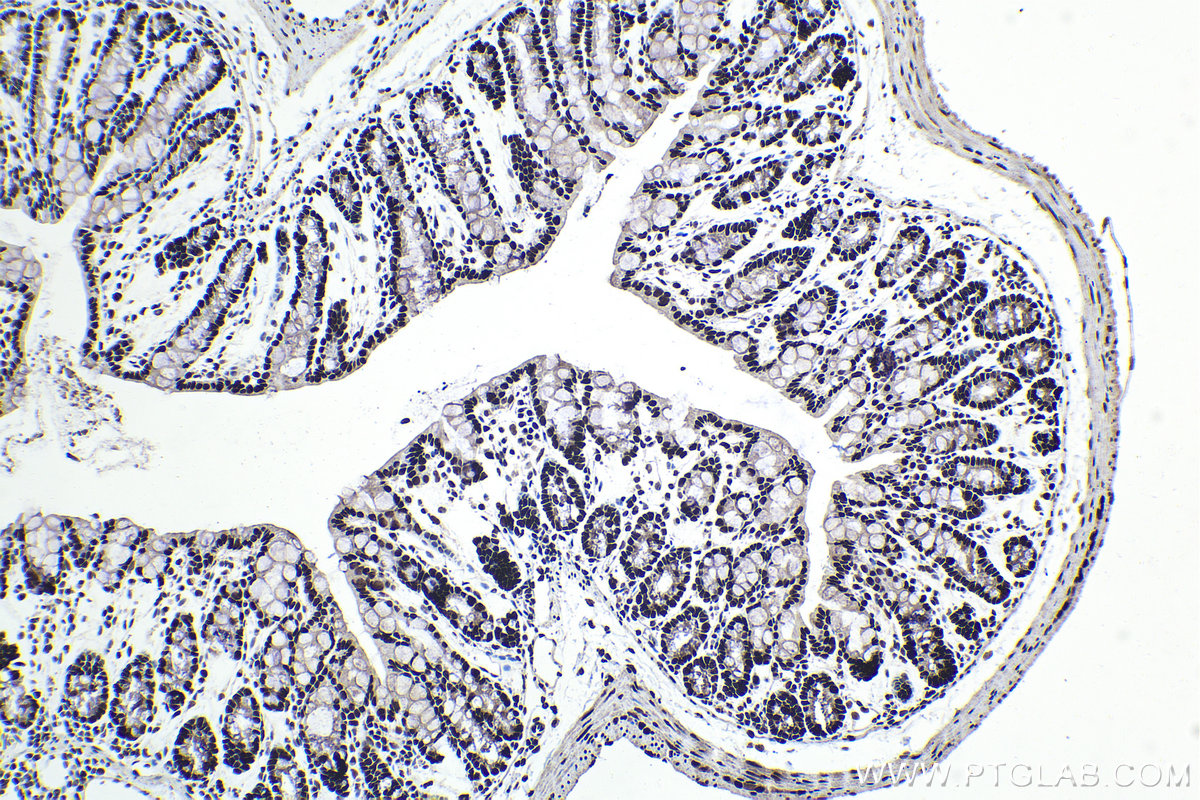 IHC staining of mouse colon using 10203-1-AP