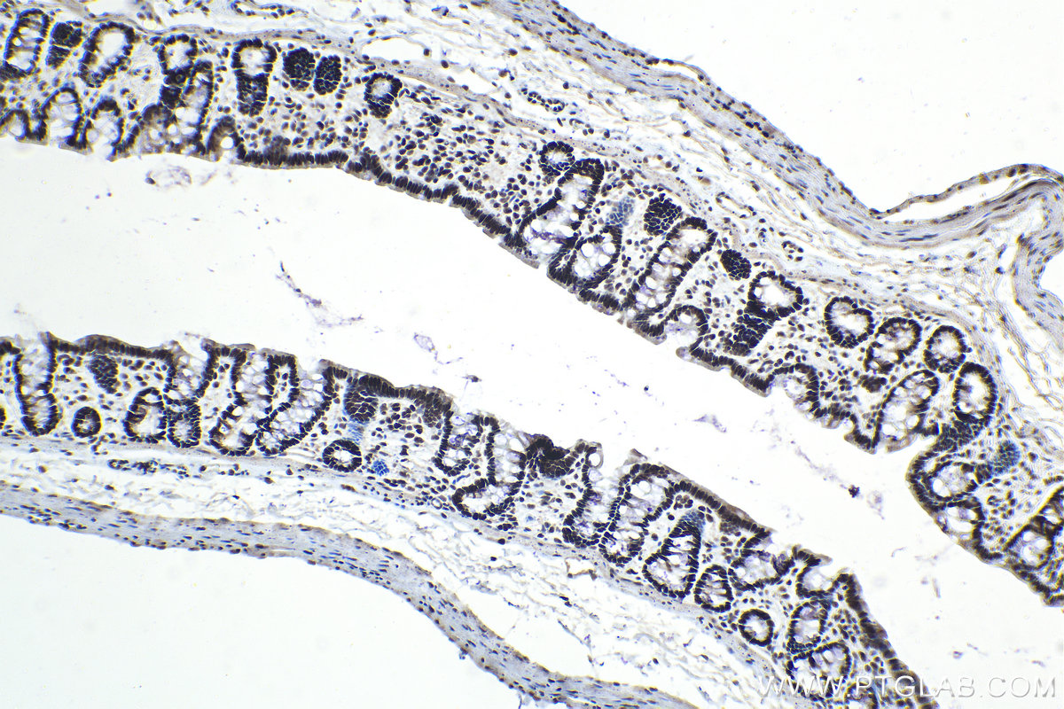 IHC staining of rat colon using 10203-1-AP