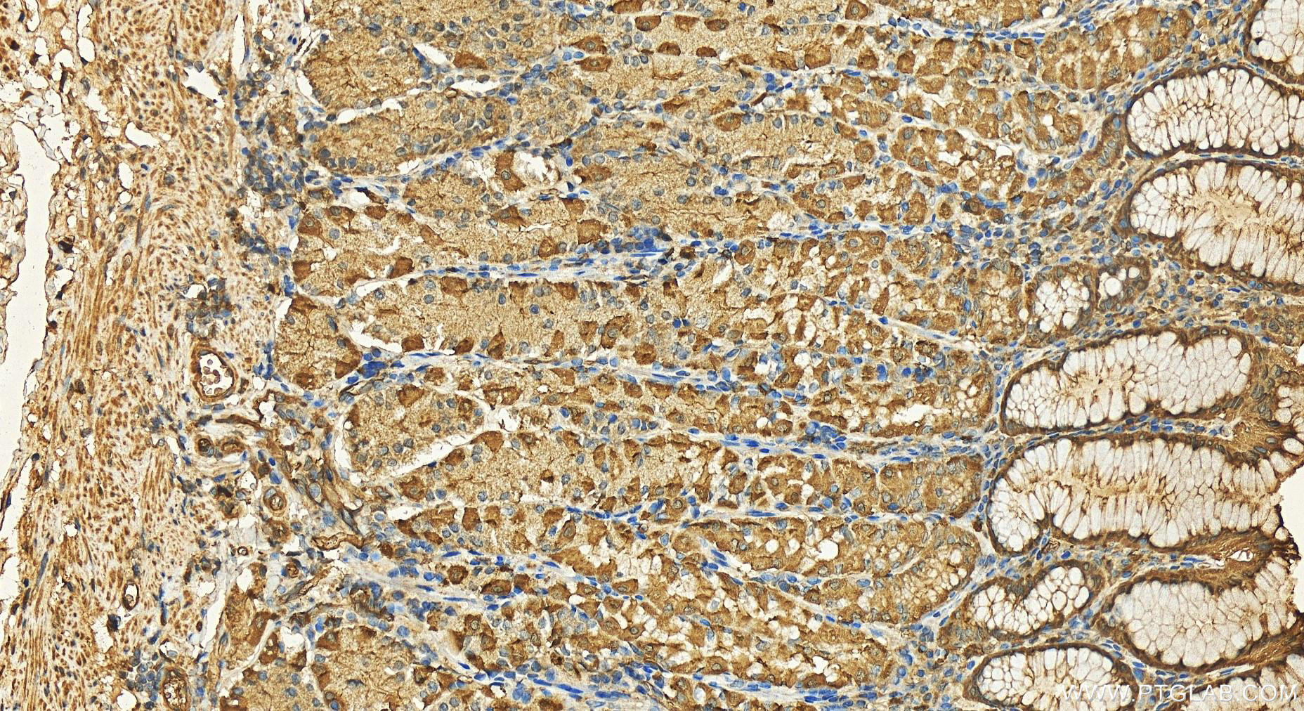 IHC staining of human stomach using 11643-1-AP