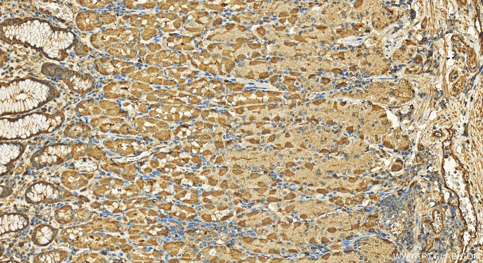 IHC staining of human stomach using 11643-1-AP