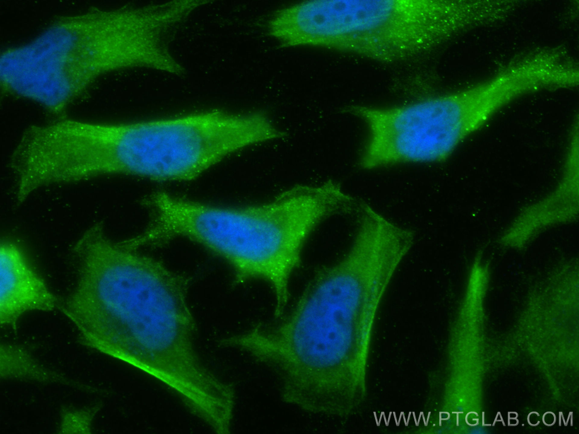 IF Staining of HeLa using 11643-1-AP