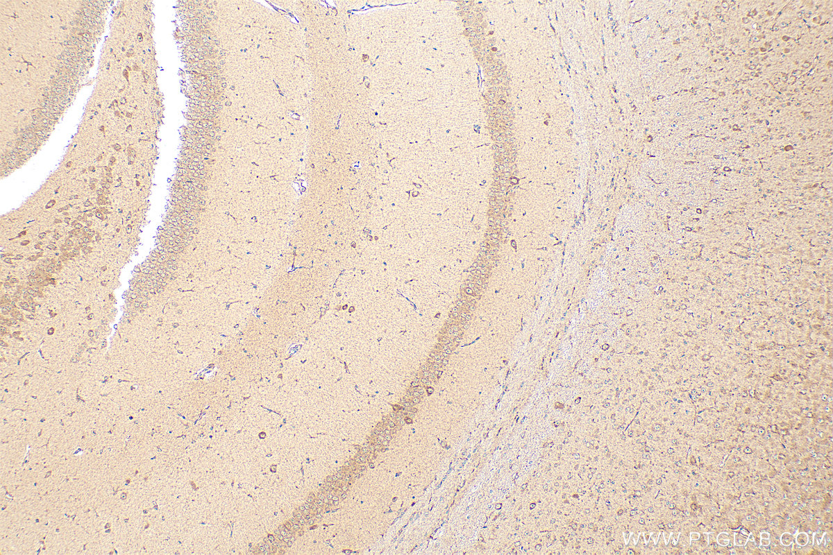 IHC staining of mouse brain using 15041-1-AP