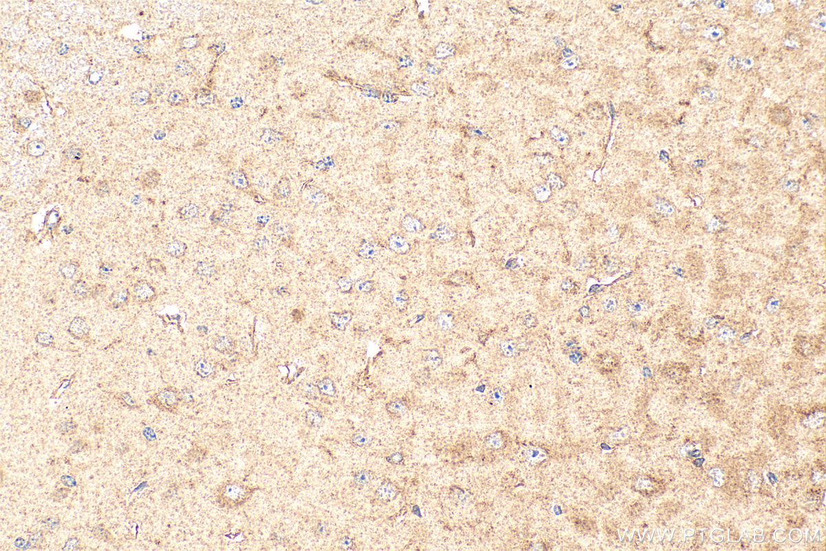 IHC staining of mouse brain using 15041-1-AP