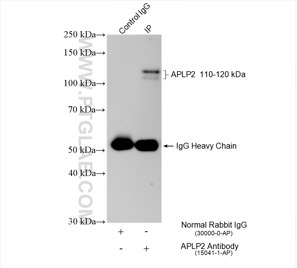 IP experiment of mouse brain using 15041-1-AP