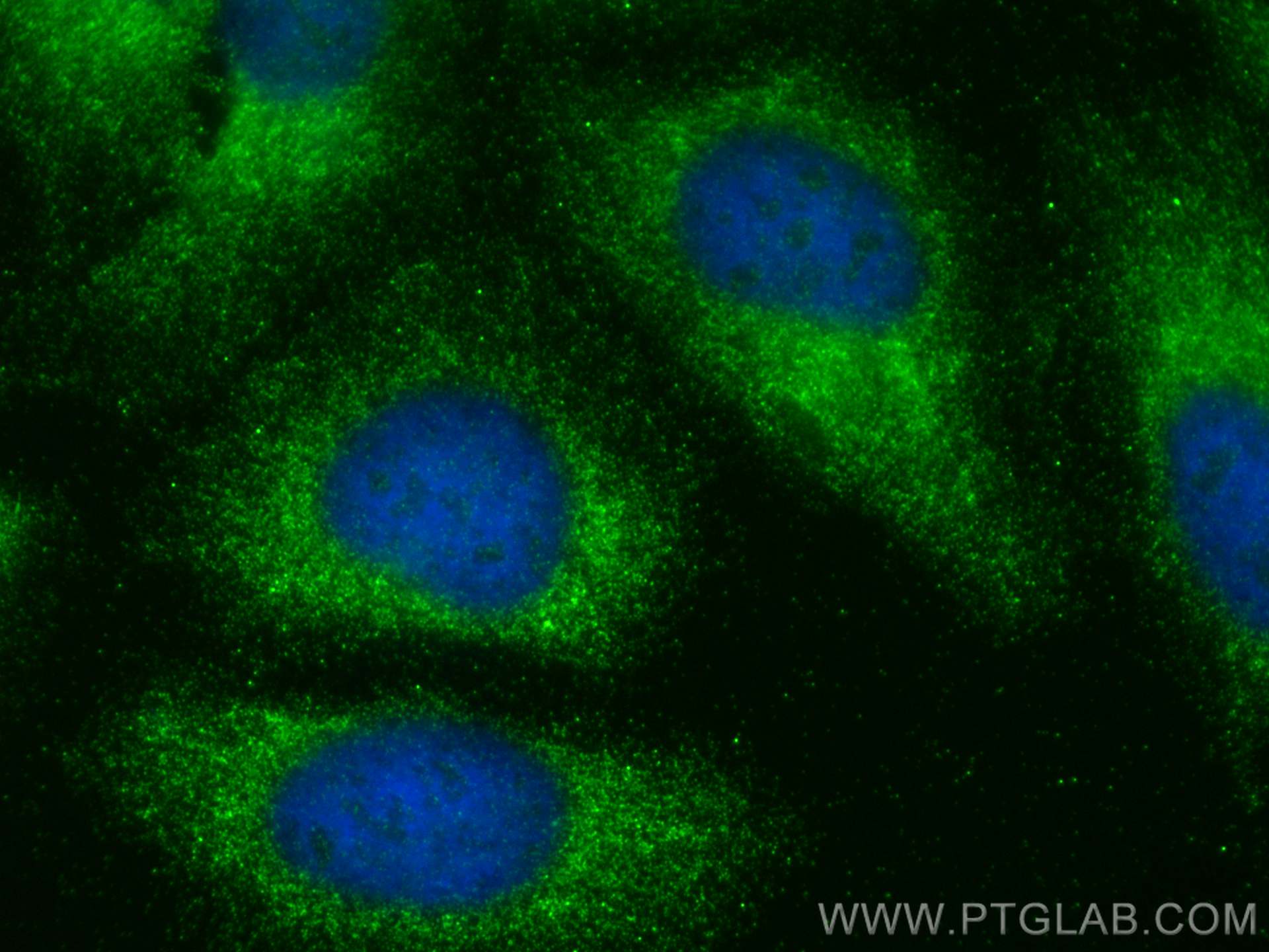 IF Staining of HeLa using 14427-1-AP