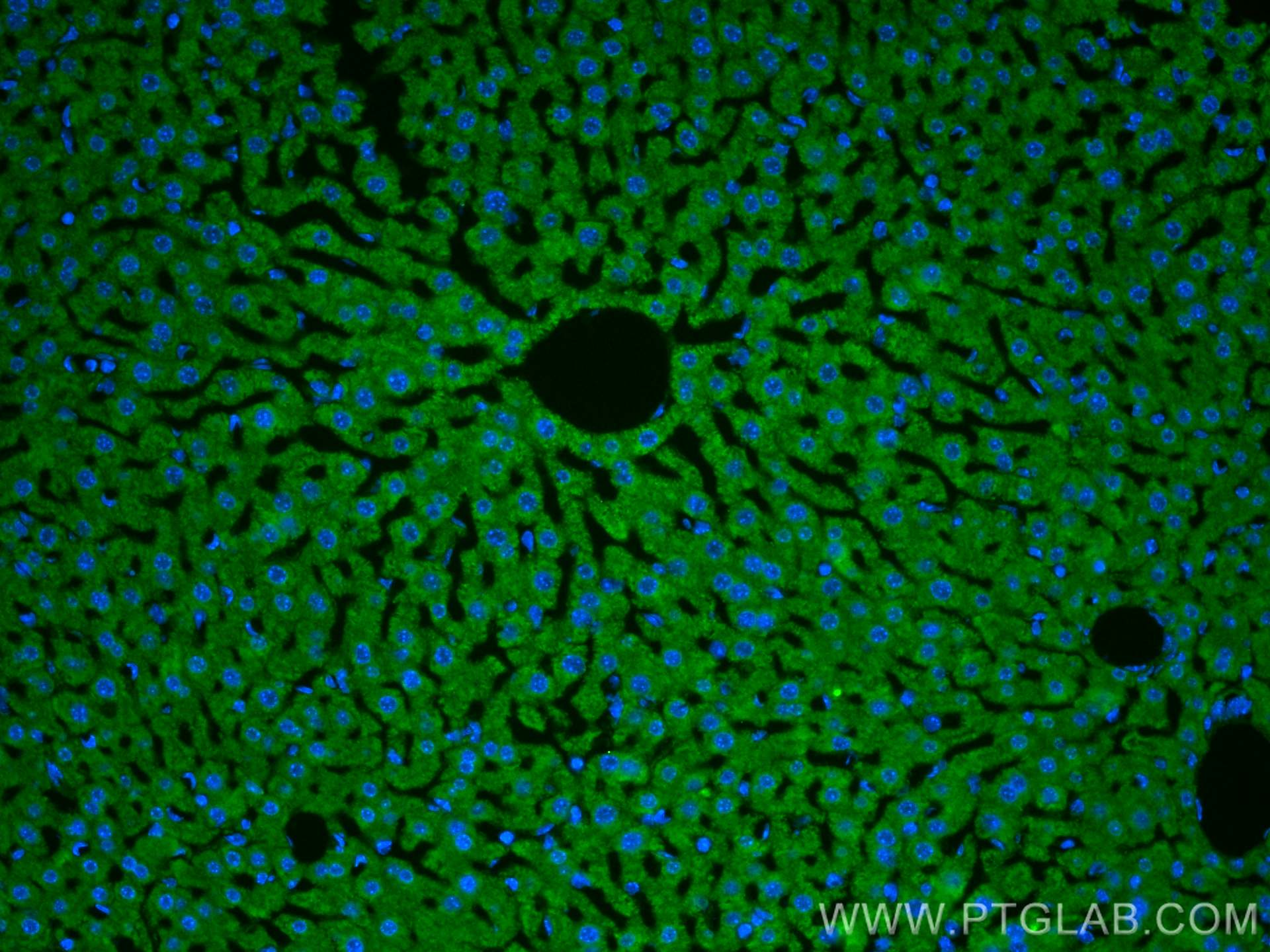 IF Staining of mouse liver using 14427-1-AP