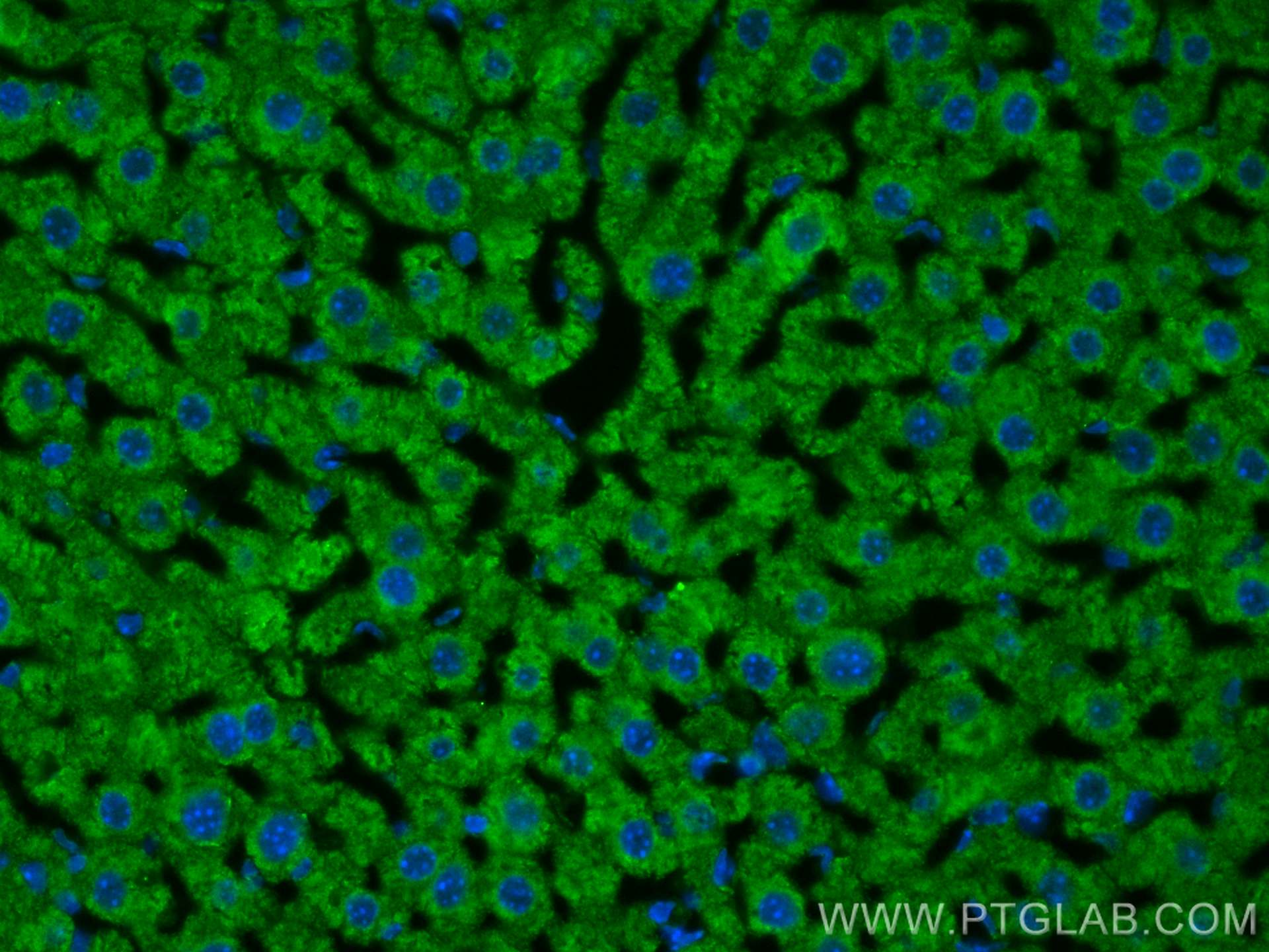 IF Staining of mouse liver using 14427-1-AP