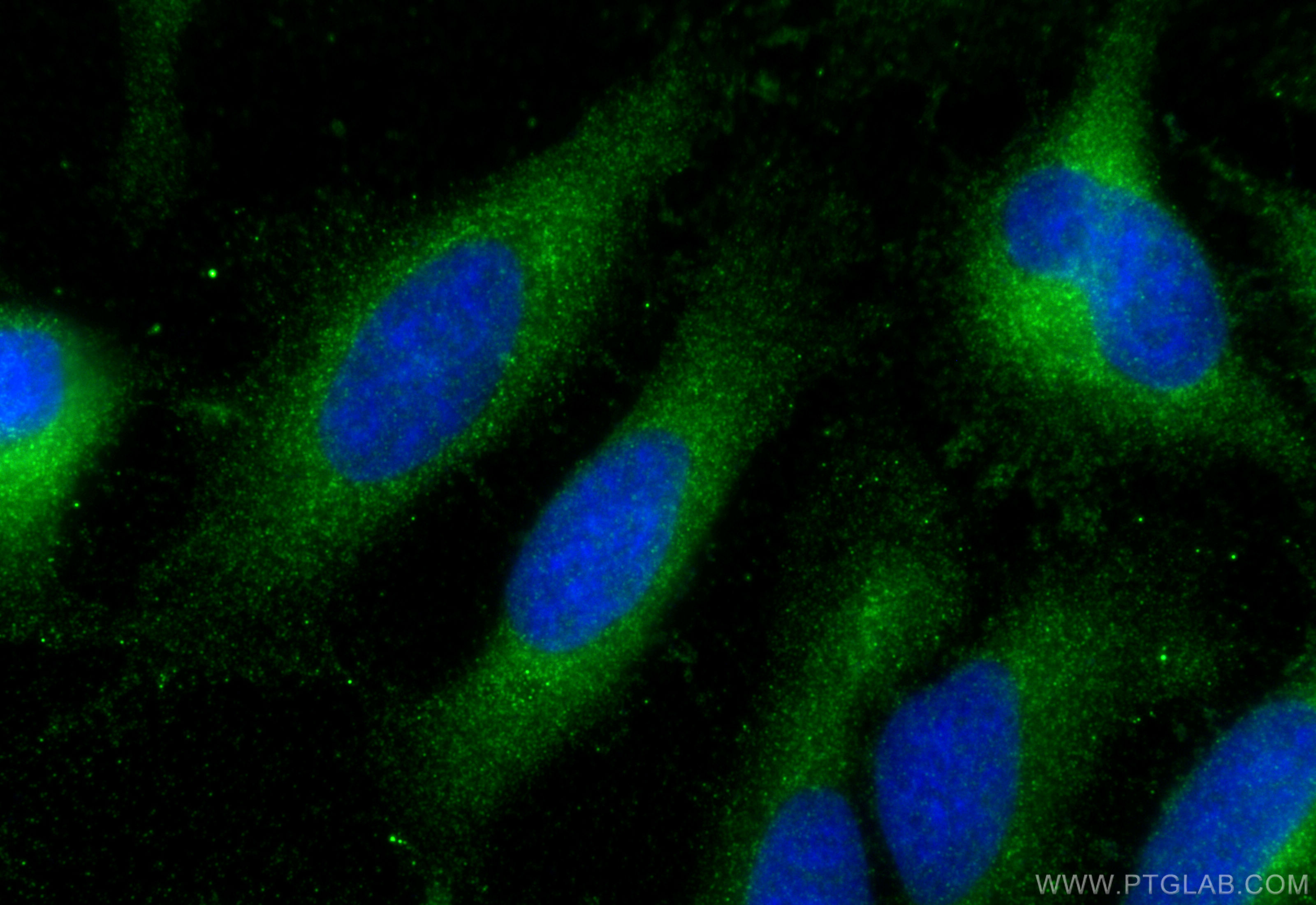 IF Staining of HeLa using 31265-1-AP