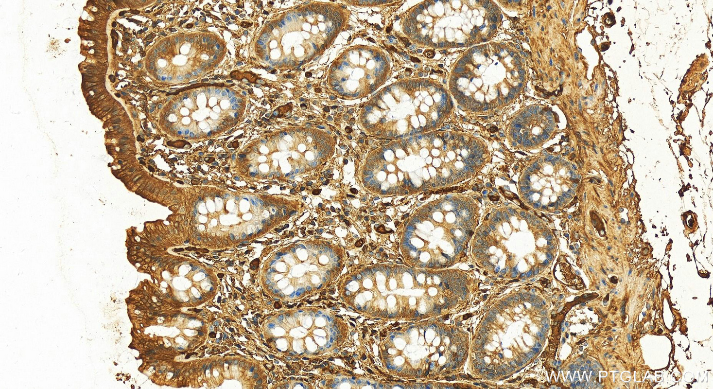 IHC staining of human colon using 16845-1-AP