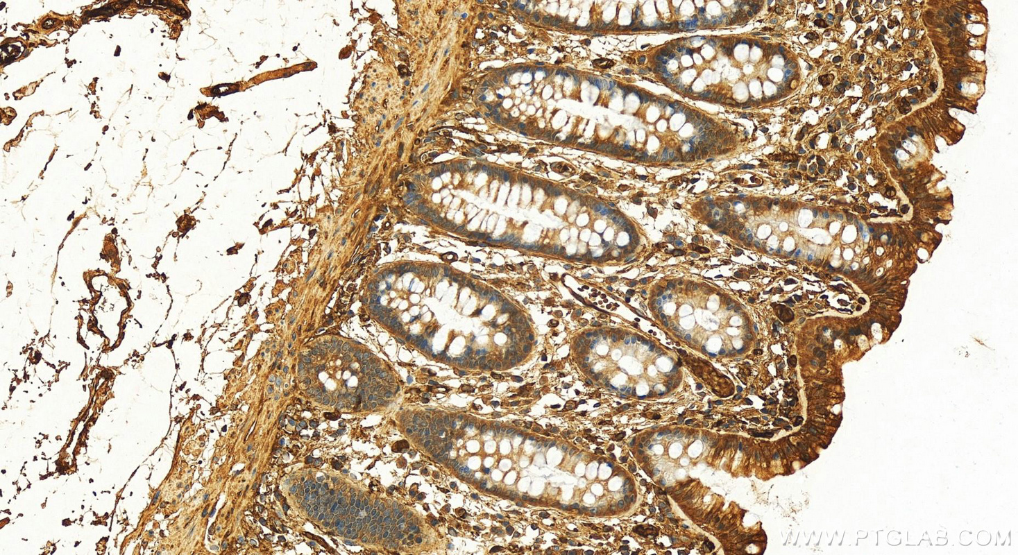 IHC staining of human colon using 16845-1-AP