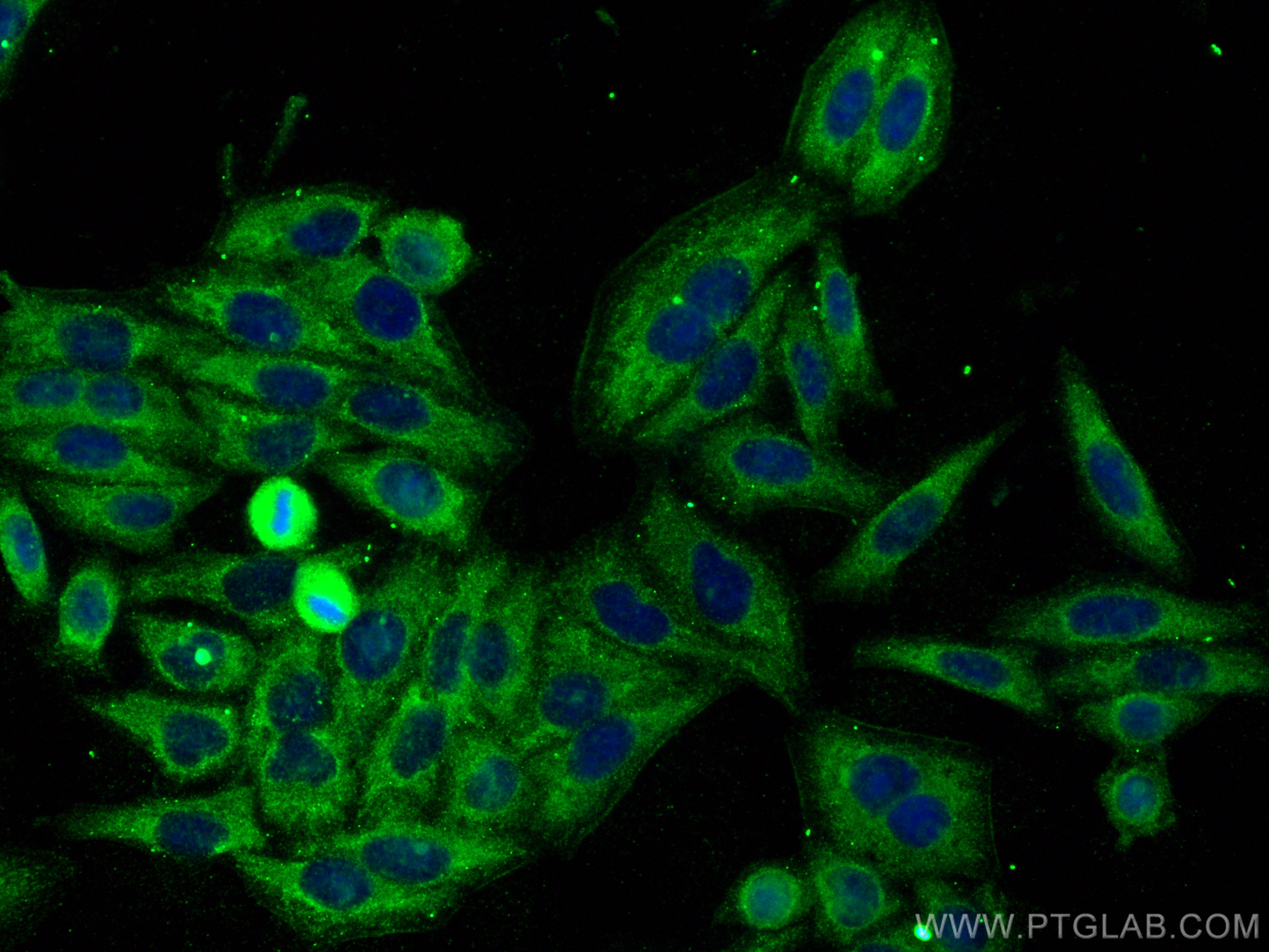 IF Staining of HepG2 using 16845-1-AP