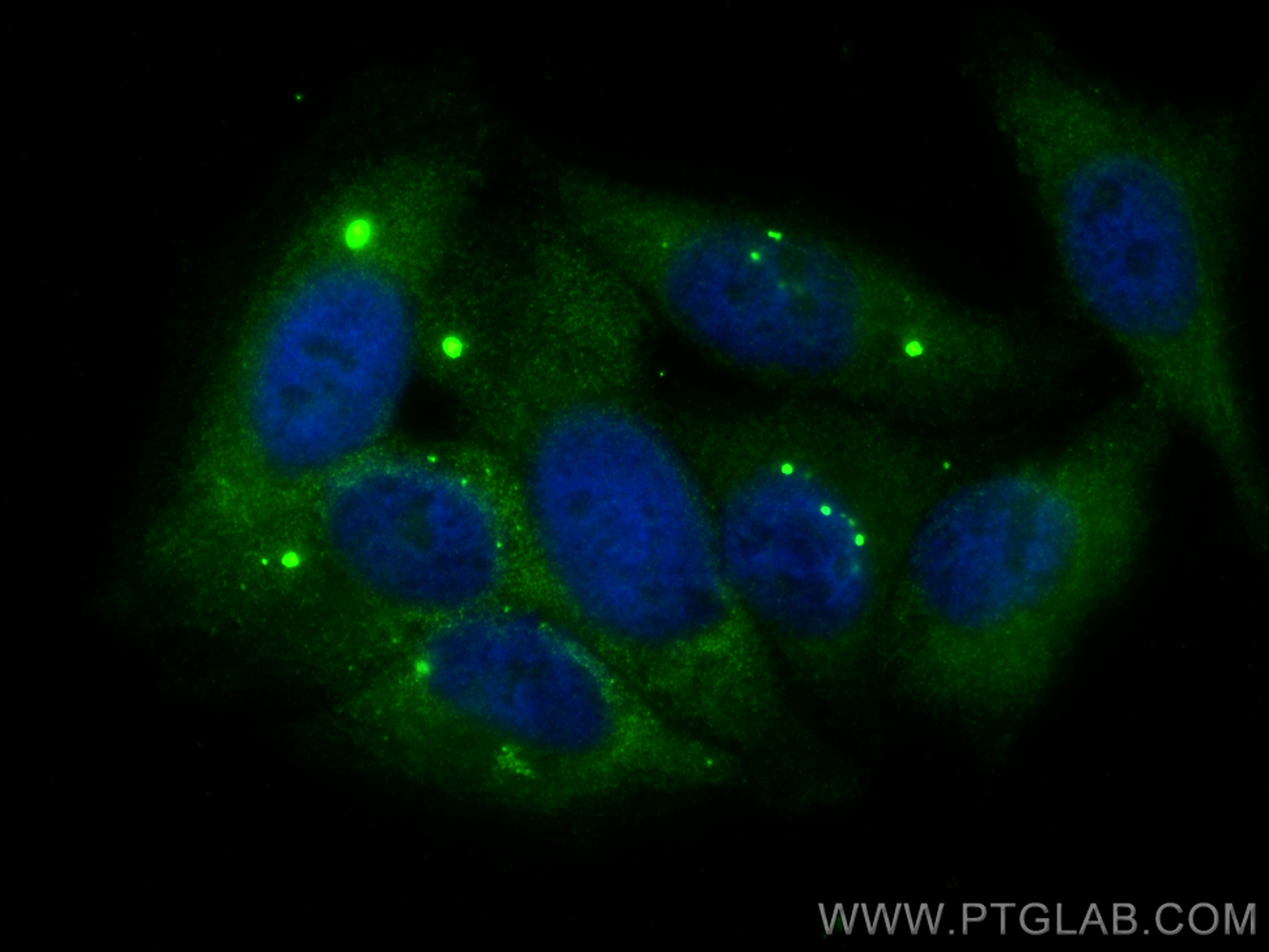 IF Staining of HepG2 using 17996-1-AP