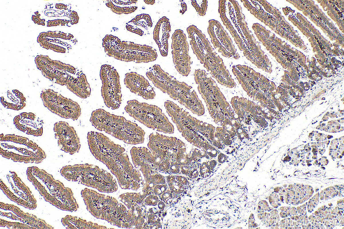 IHC staining of mouse small intestine using 66252-1-Ig (same clone as 66252-1-PBS)