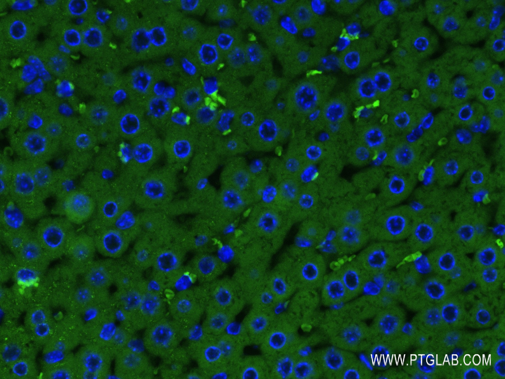 IF Staining of mouse liver using 84047-1-RR