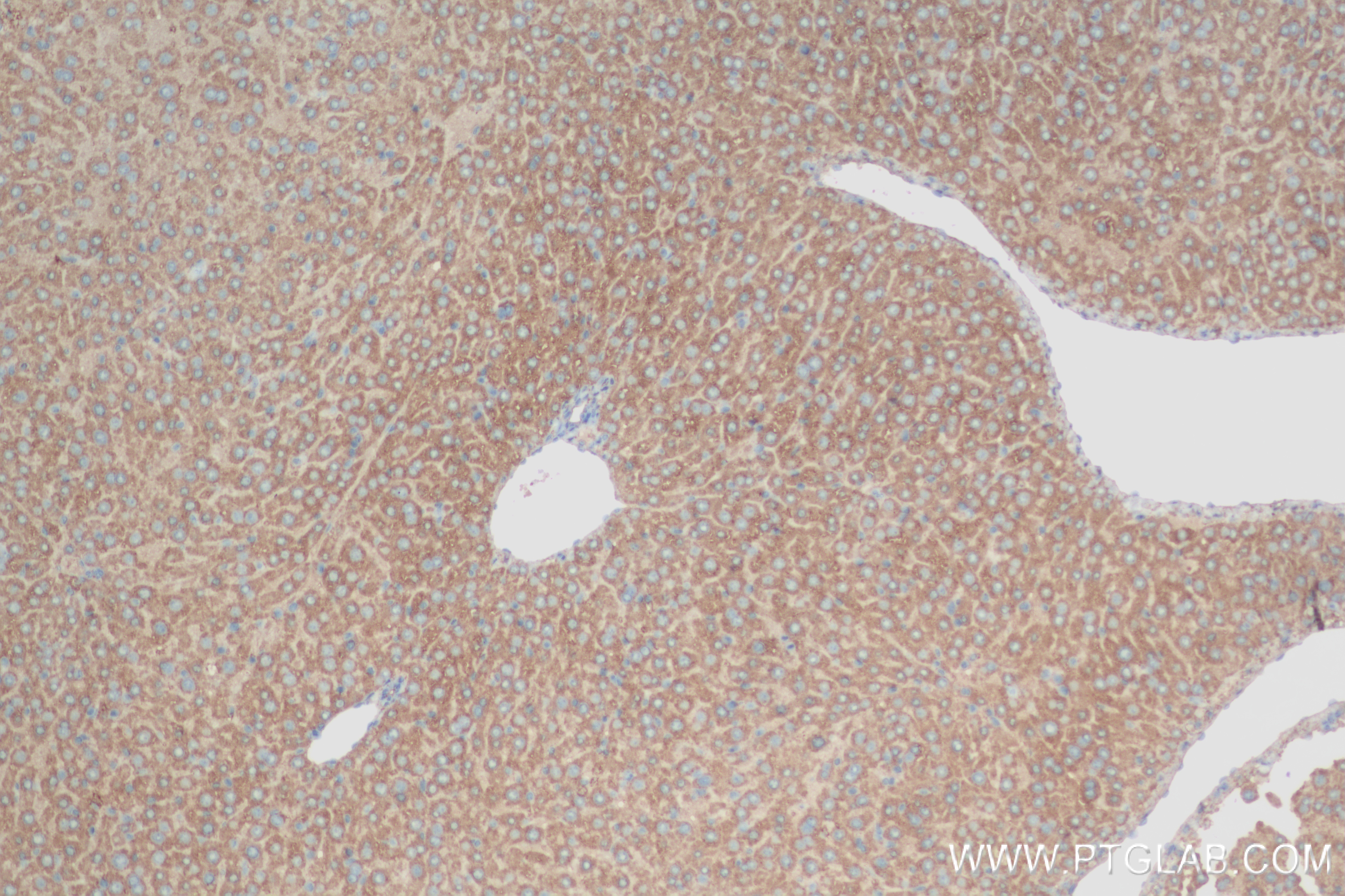 IHC staining of mouse liver using 84047-1-RR