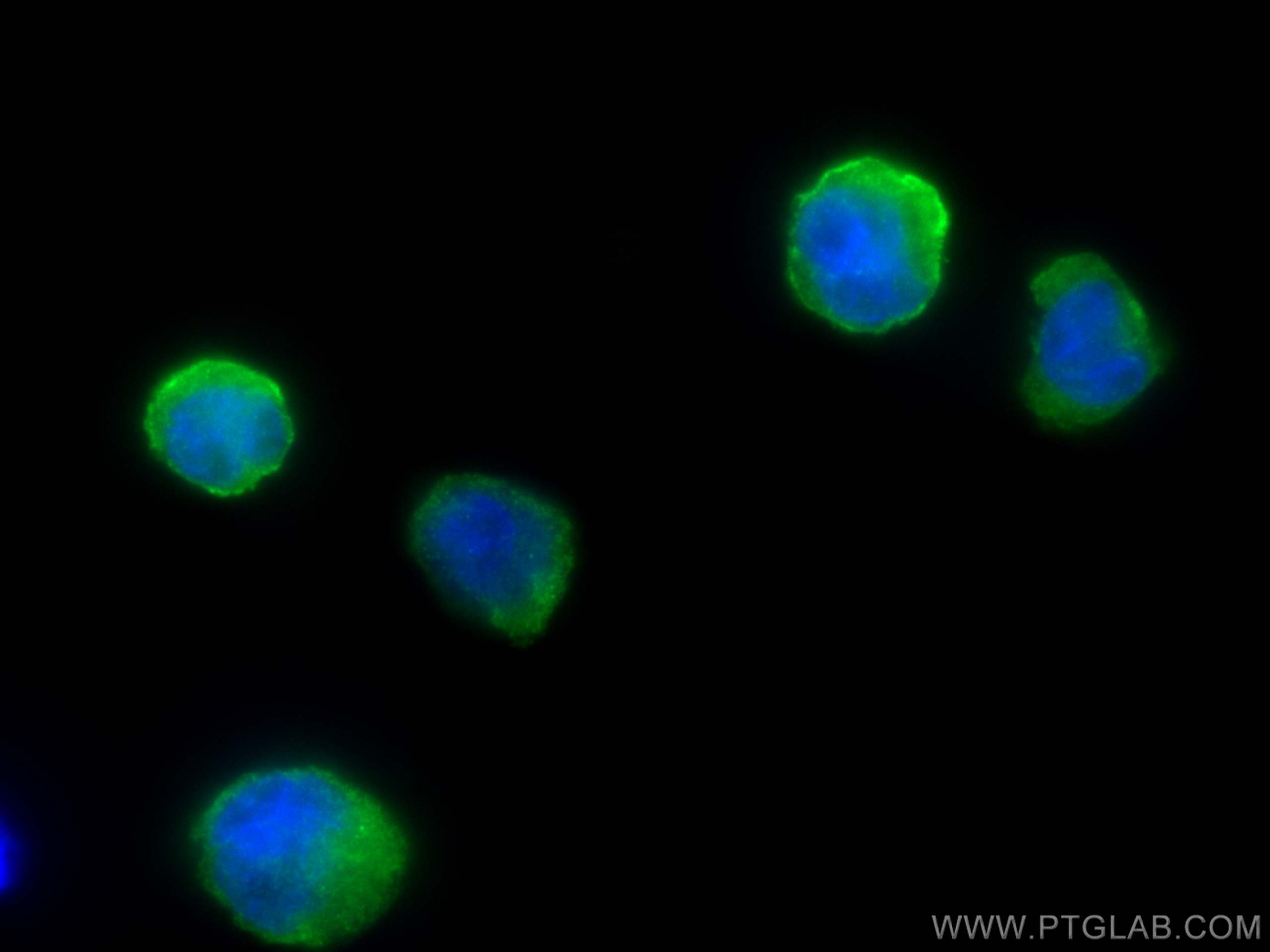 IF Staining of THP-1 using 25084-1-AP