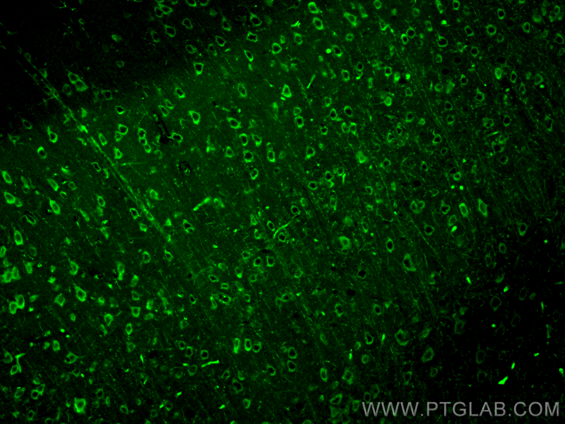 IF Staining of mouse brain using 30535-1-AP