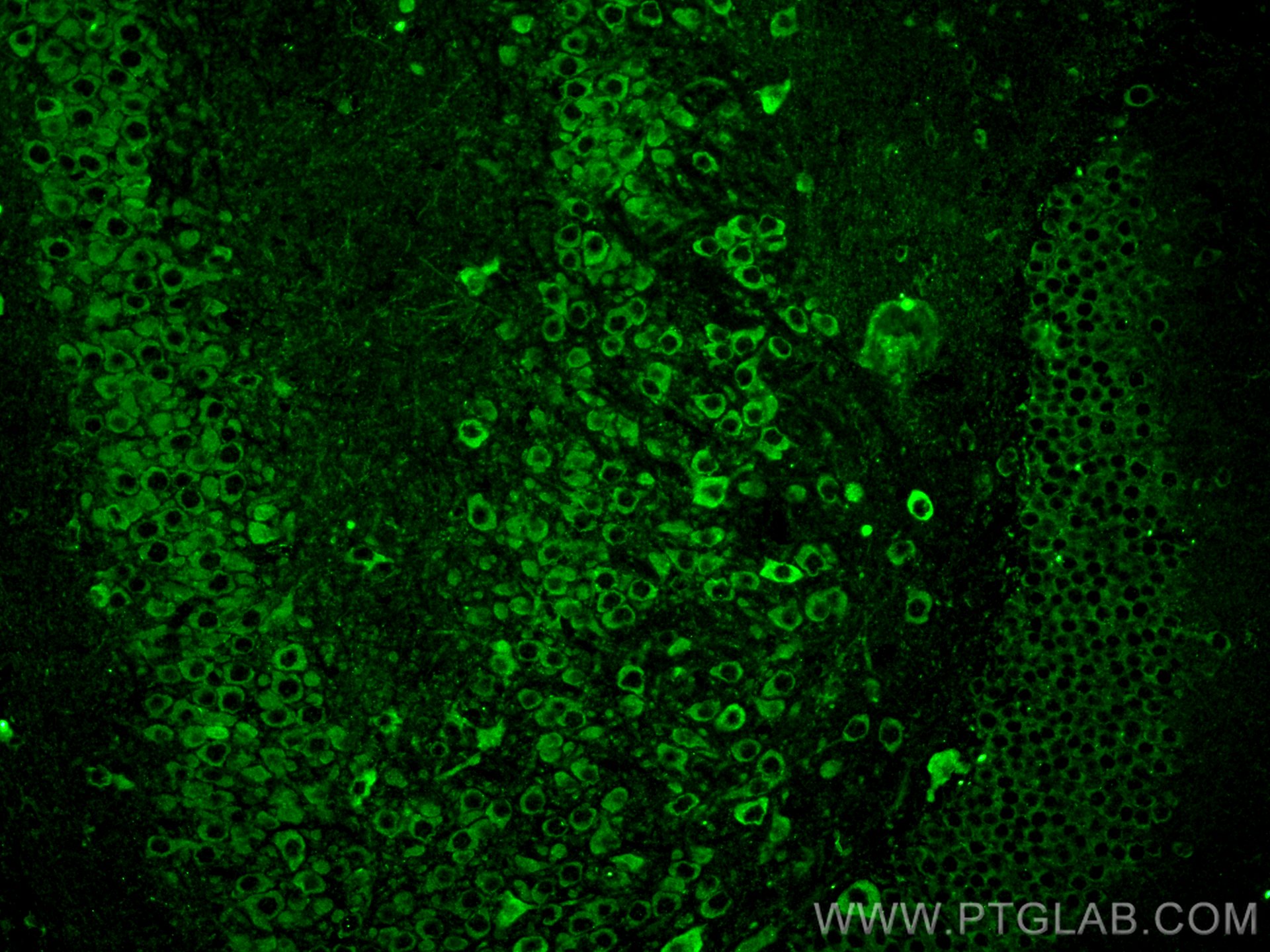 IF Staining of mouse brain using 66830-1-Ig