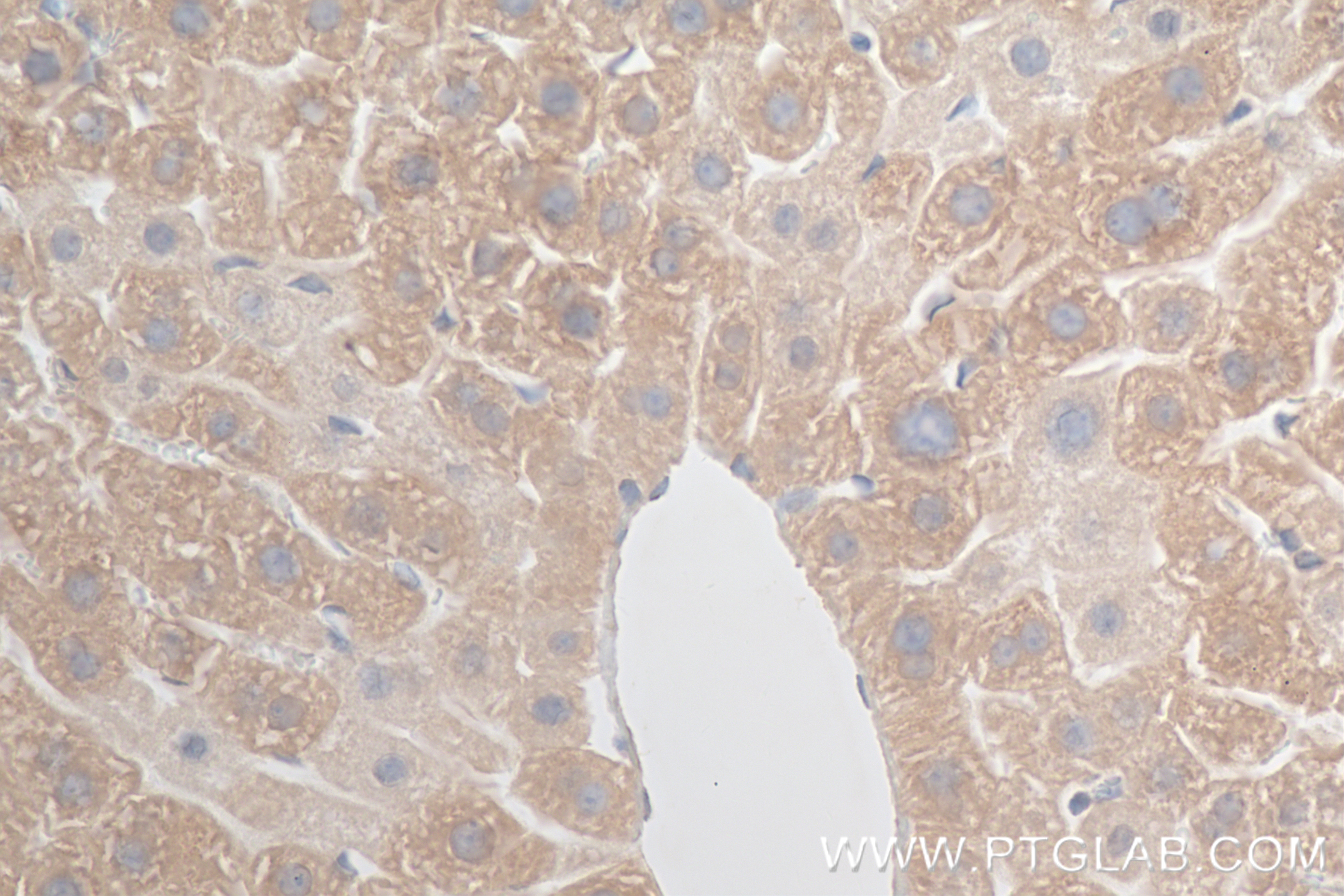 IHC staining of mouse liver using 84775-7-RR