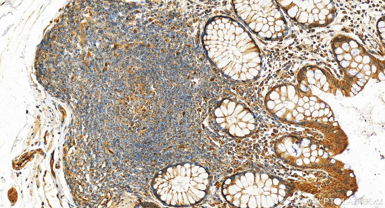 IHC staining of human normal colon using 11892-1-AP