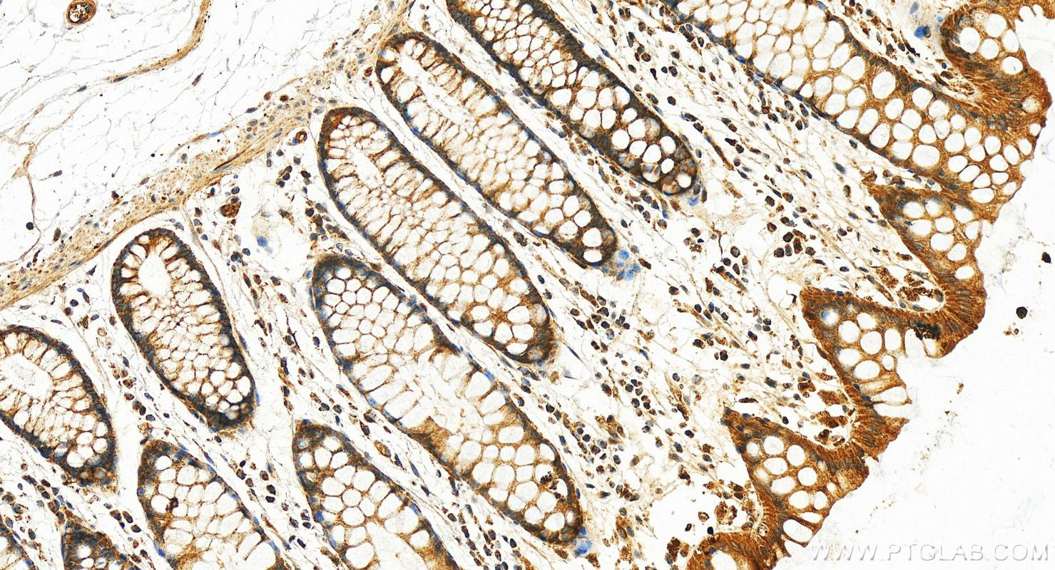 IHC staining of human normal colon using 11892-1-AP