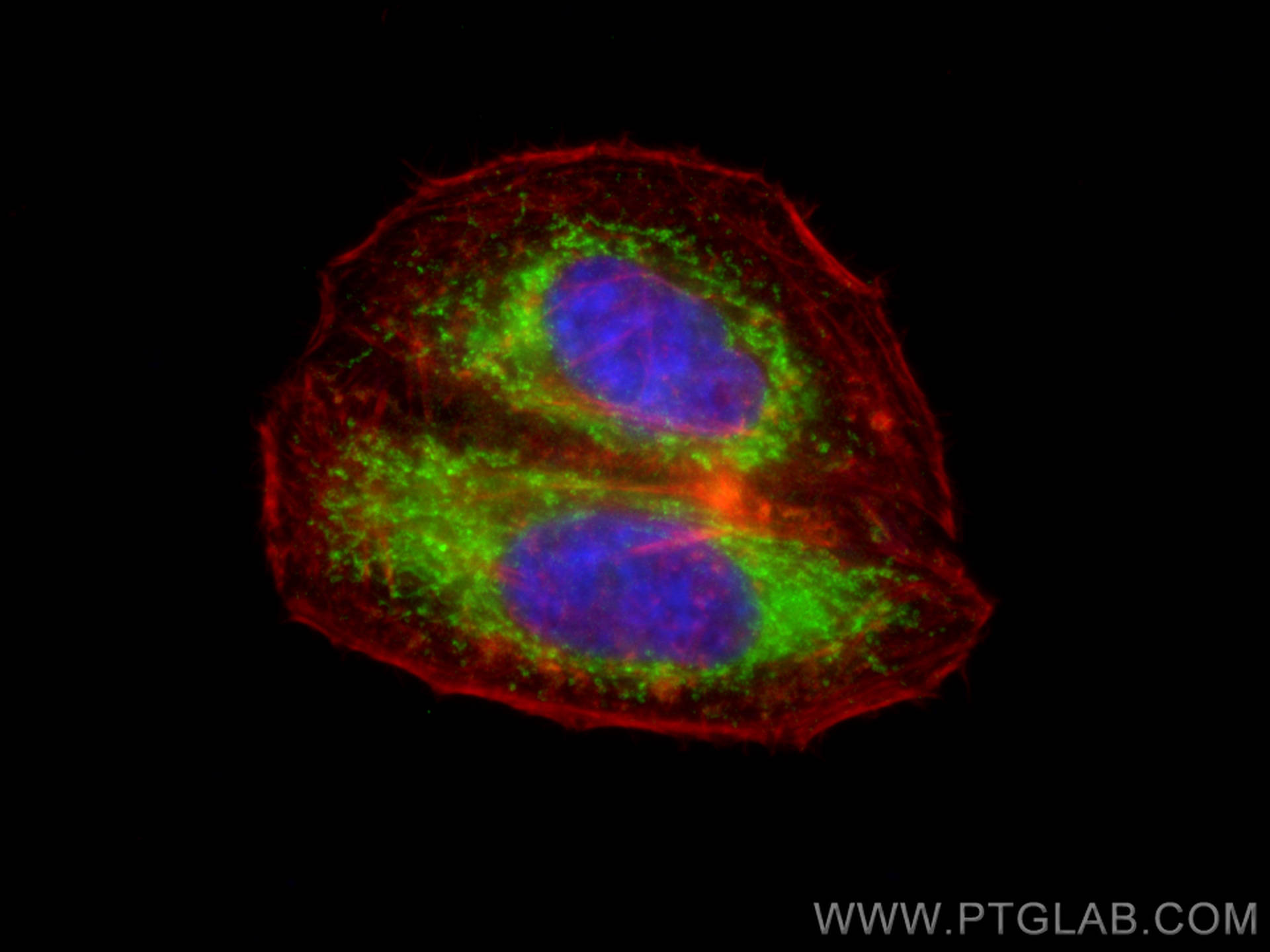 IF Staining of HepG2 using 11892-1-AP