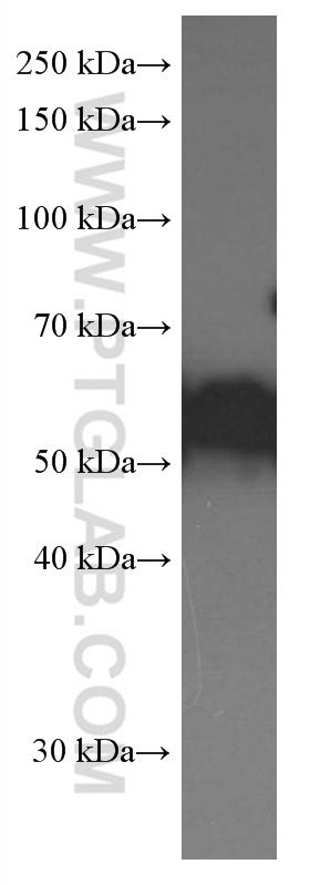 Apolipoprotein H