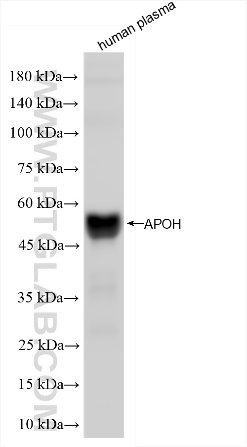 WB analysis of human plasma using 84943-2-RR