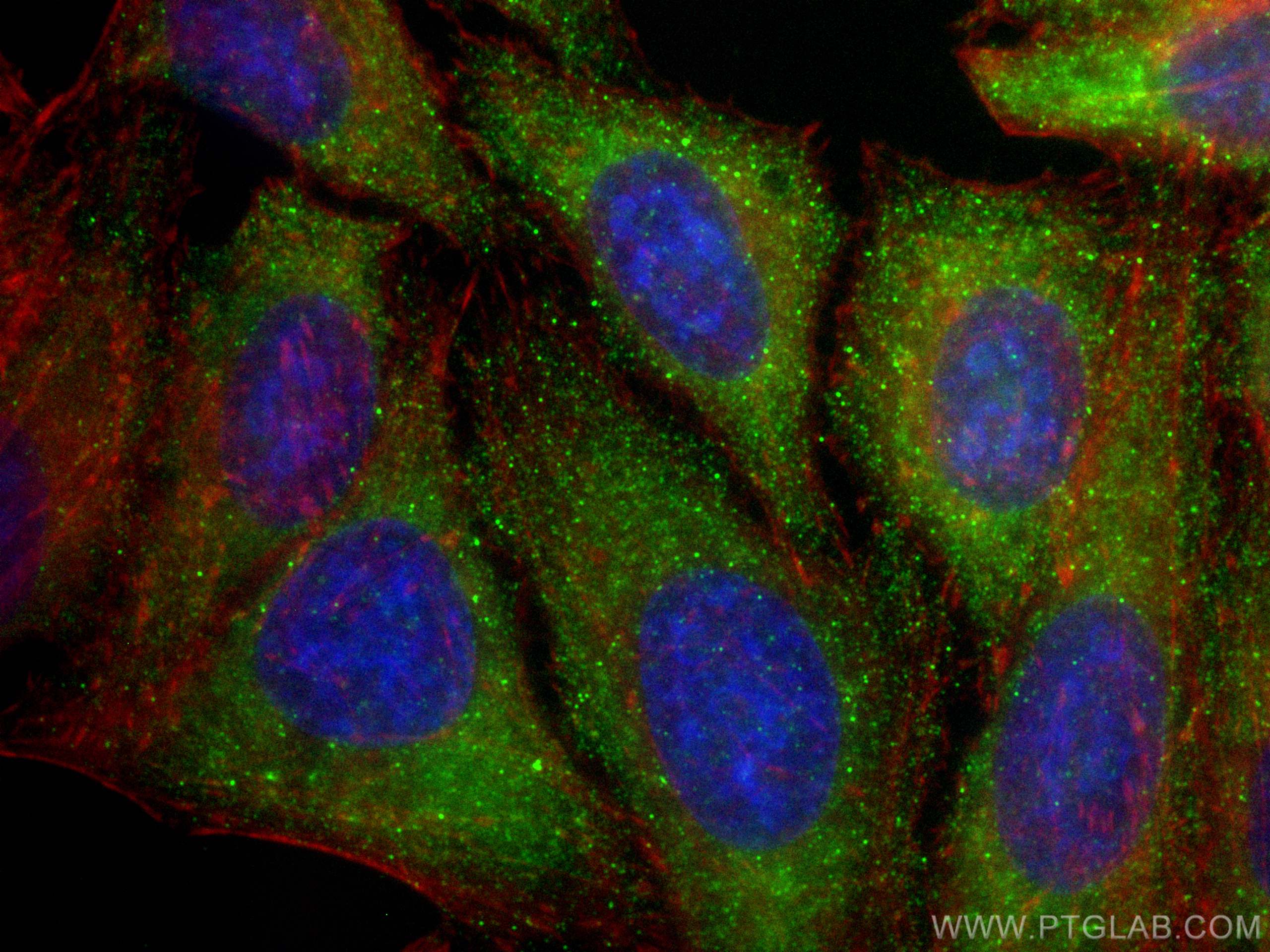 IF Staining of HepG2 using 66124-1-Ig