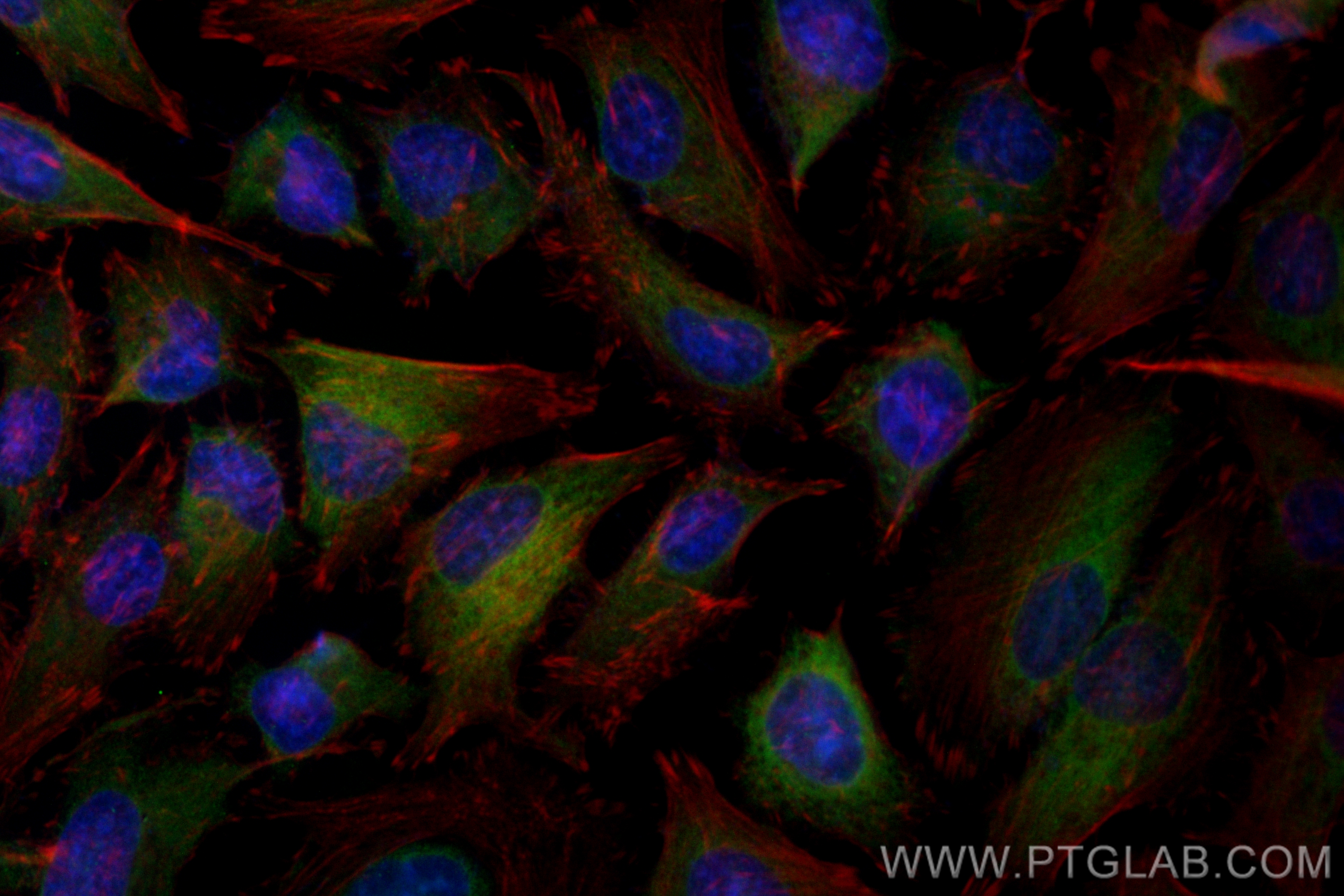 IF Staining of HeLa using CL488-25925