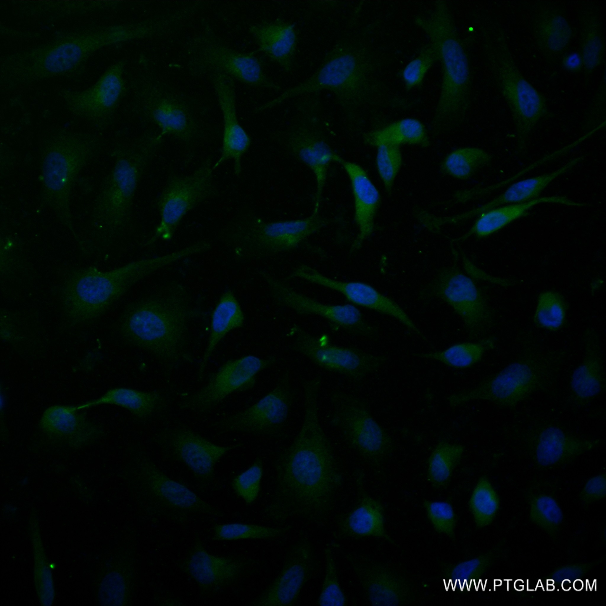 IF Staining of HeLa using 82877-2-RR (same clone as 82877-2-PBS)