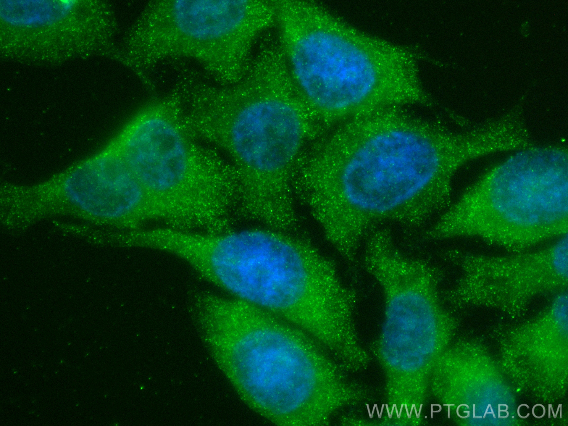 IF Staining of HepG2 using 82871-1-RR