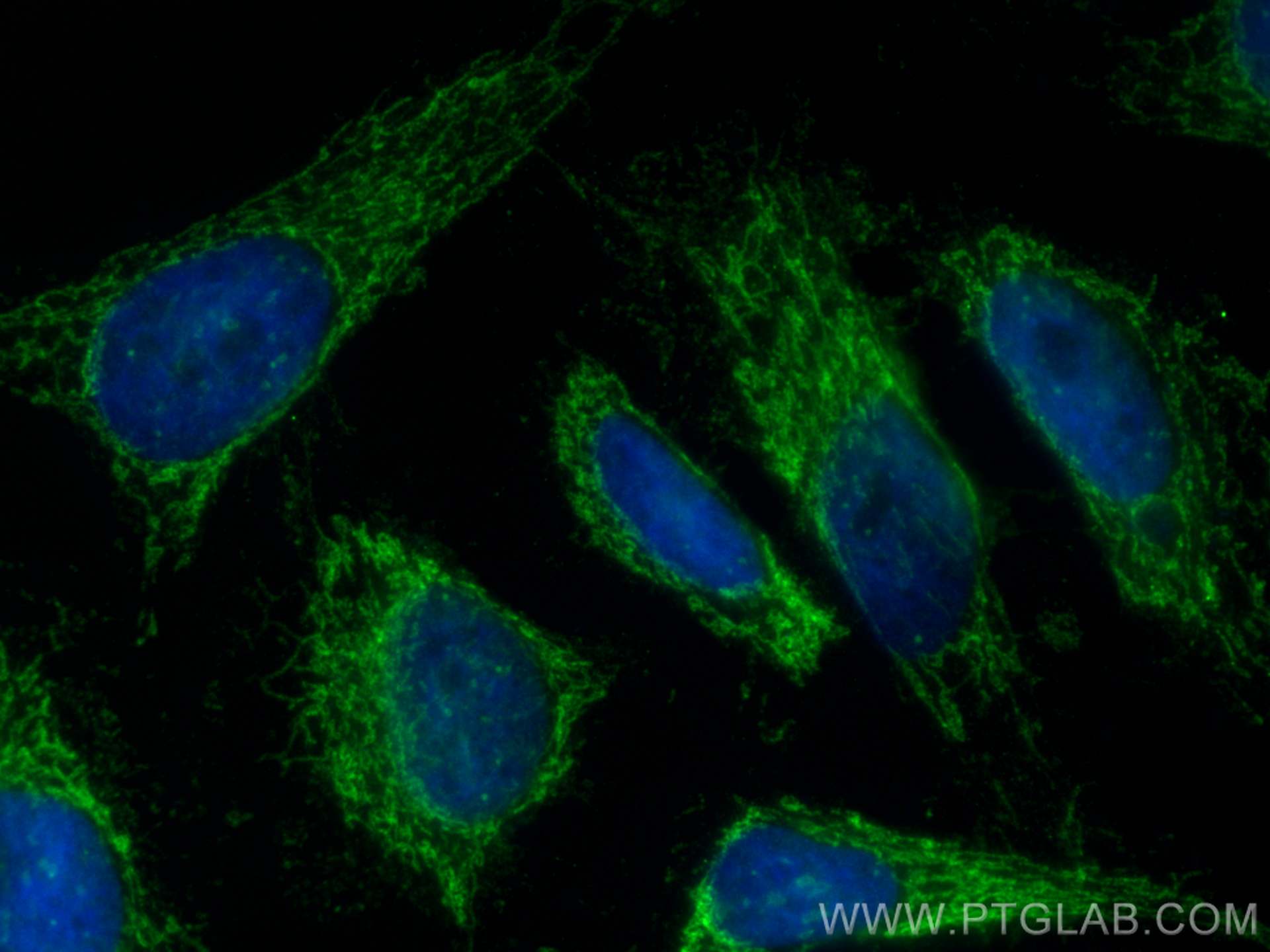 IF Staining of HeLa using 28514-1-AP