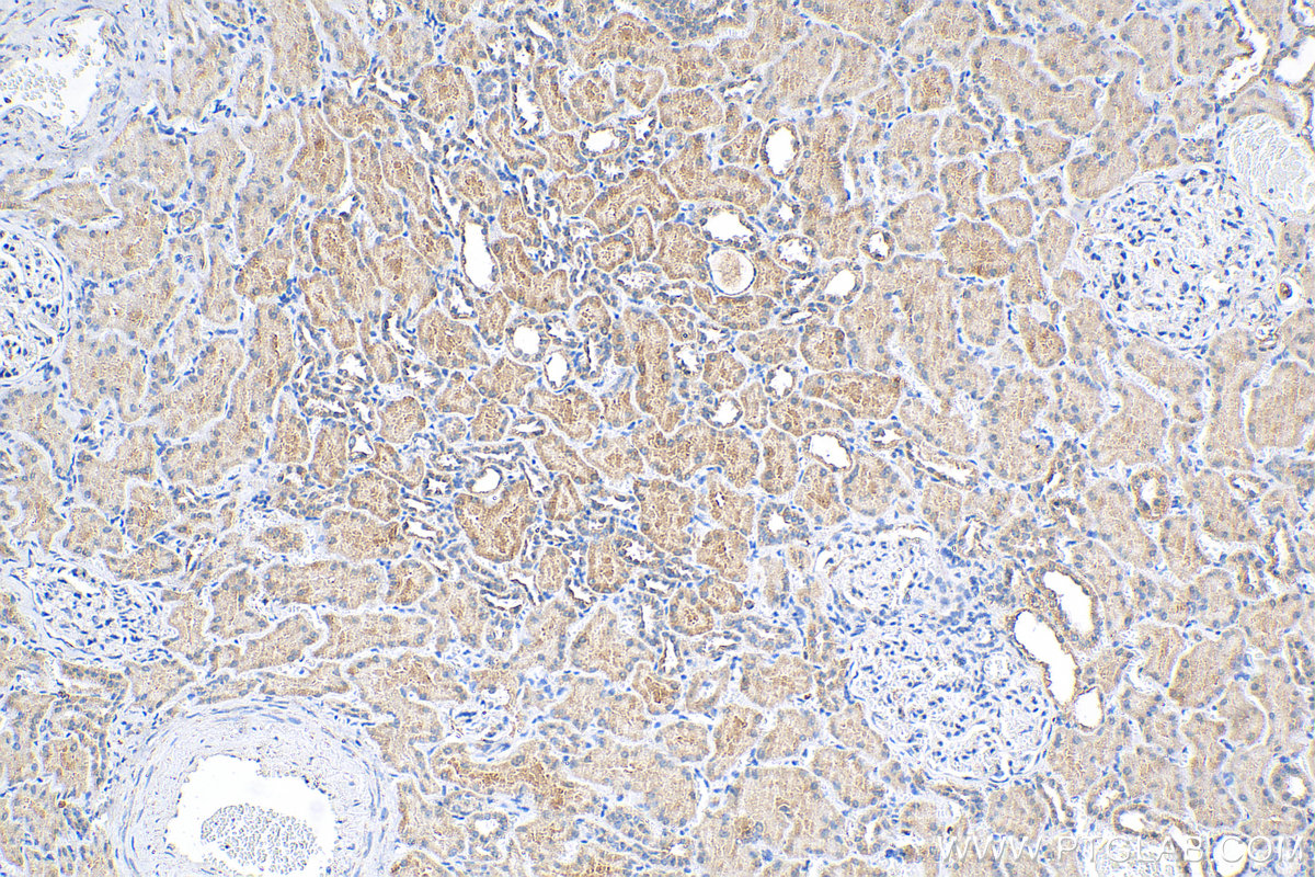 IHC staining of human kidney using 28514-1-AP