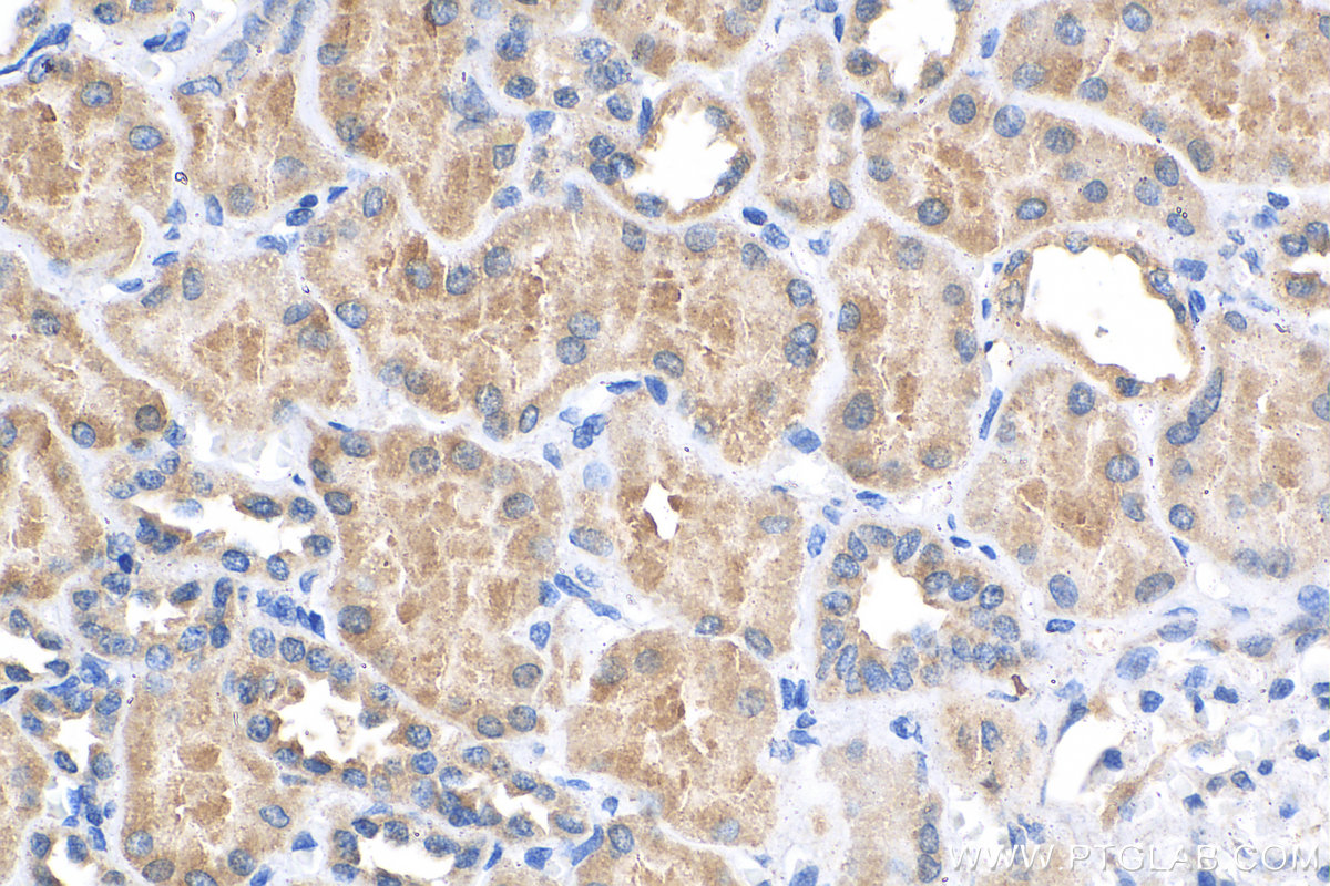 IHC staining of human kidney using 28514-1-AP