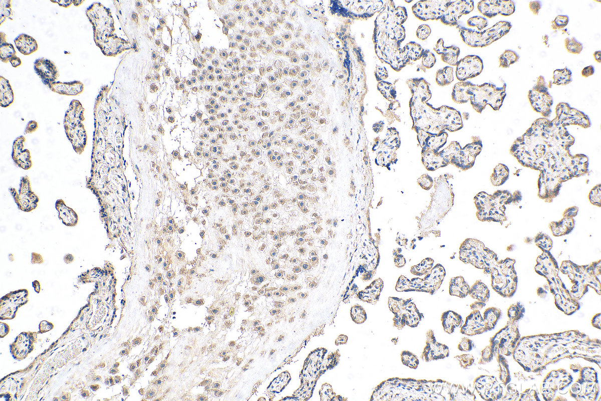 IHC staining of human placenta using 28514-1-AP