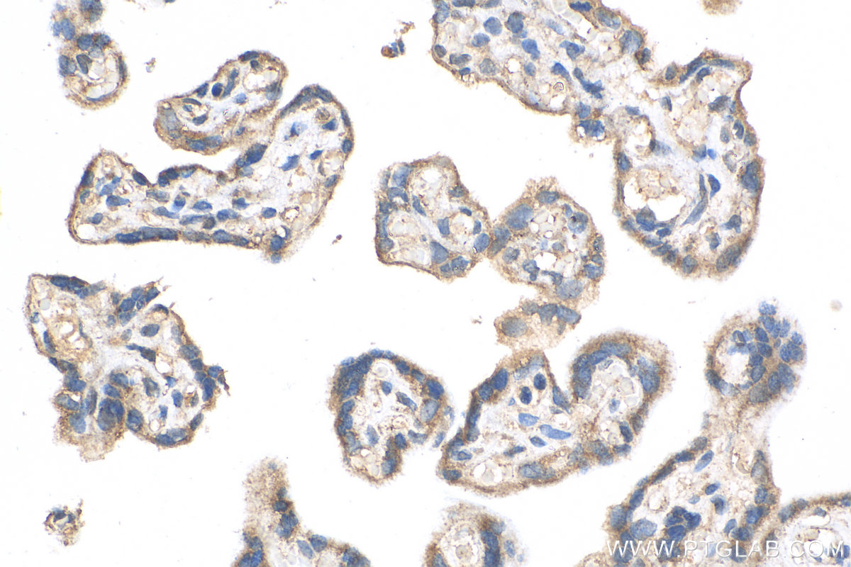 IHC staining of human placenta using 28514-1-AP