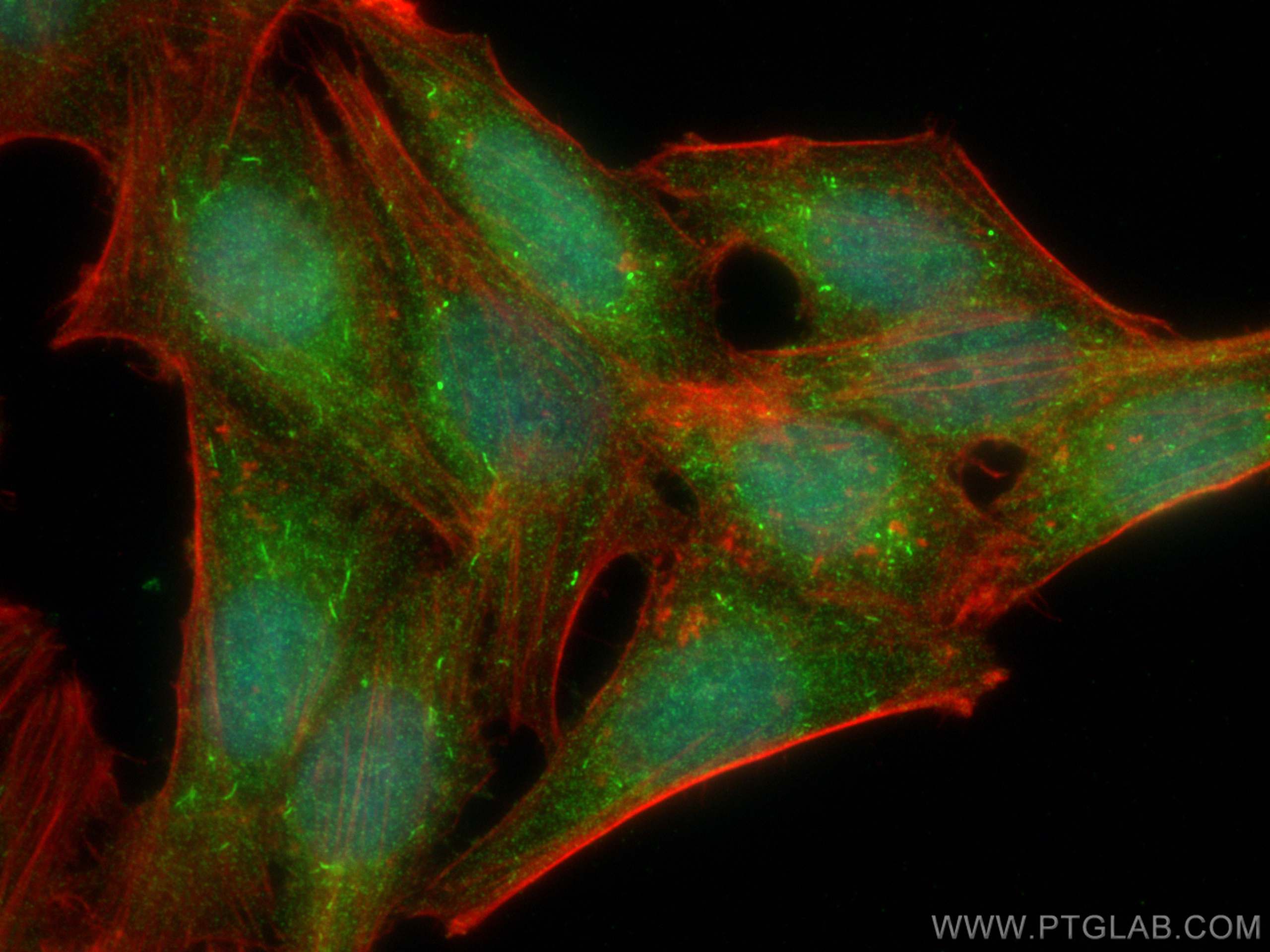 IF Staining of HepG2 using 19885-1-AP