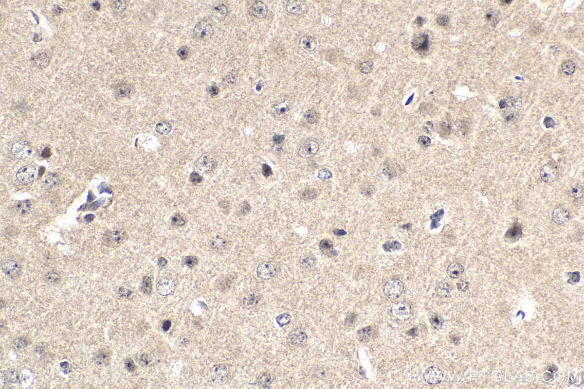 IHC staining of mouse brain using 14294-1-AP