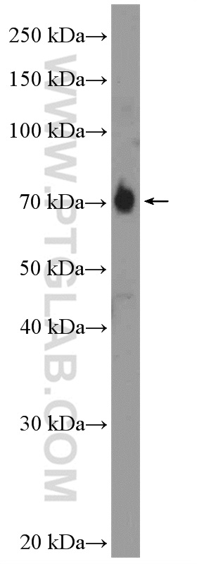 WB analysis of BxPC-3 using 14294-1-AP